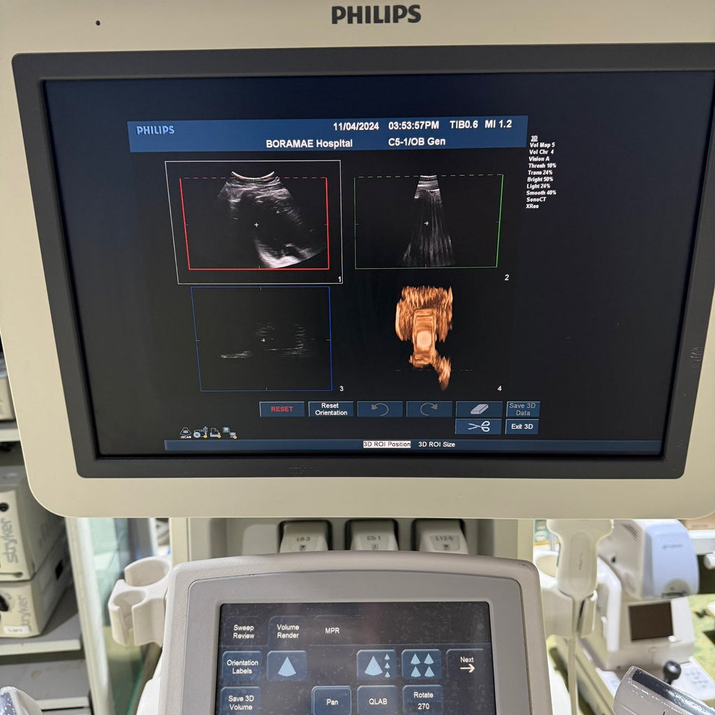 Philips IU22 with Convex & Linear 3 Probes