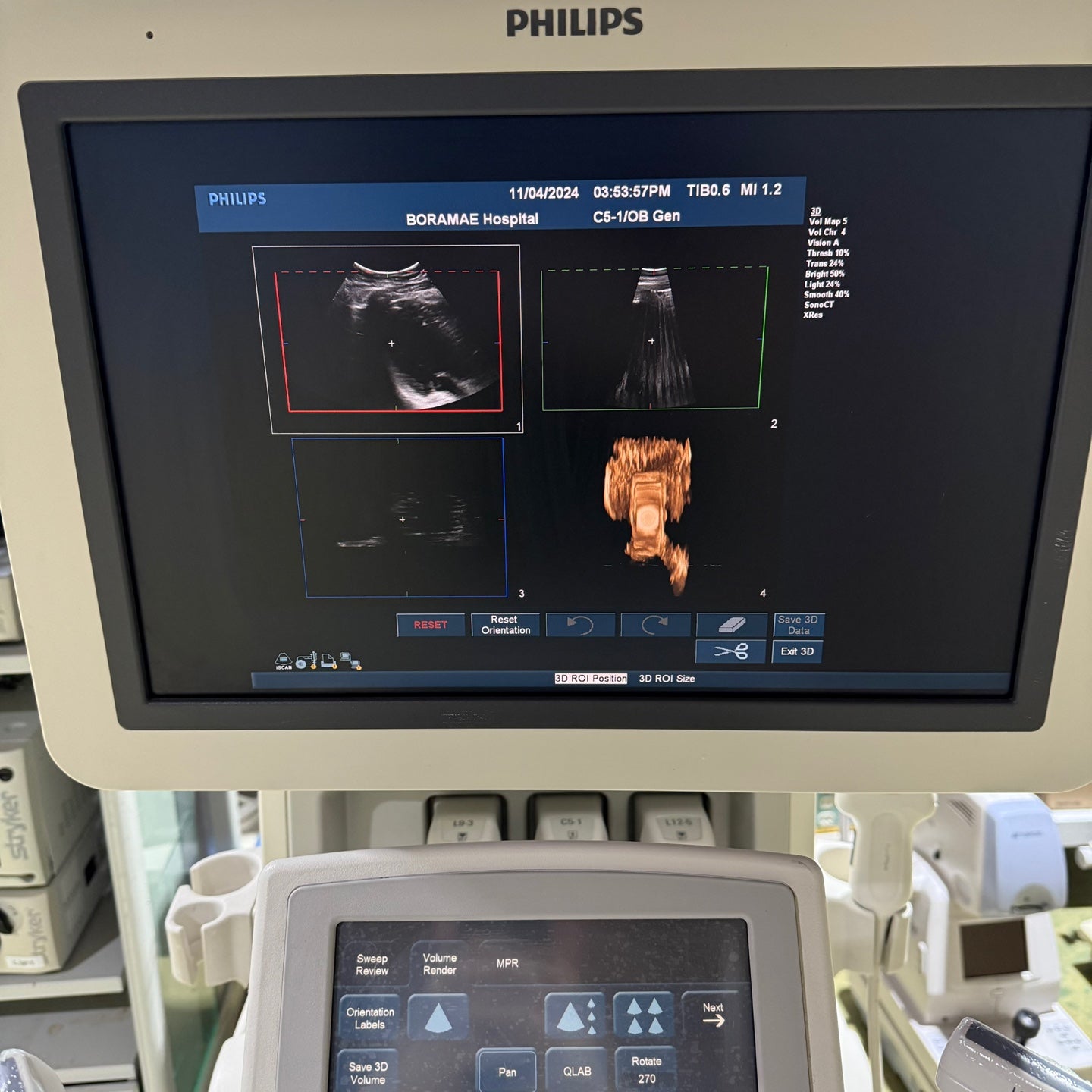 Philips IU22 with Convex & Linear 3 Probes