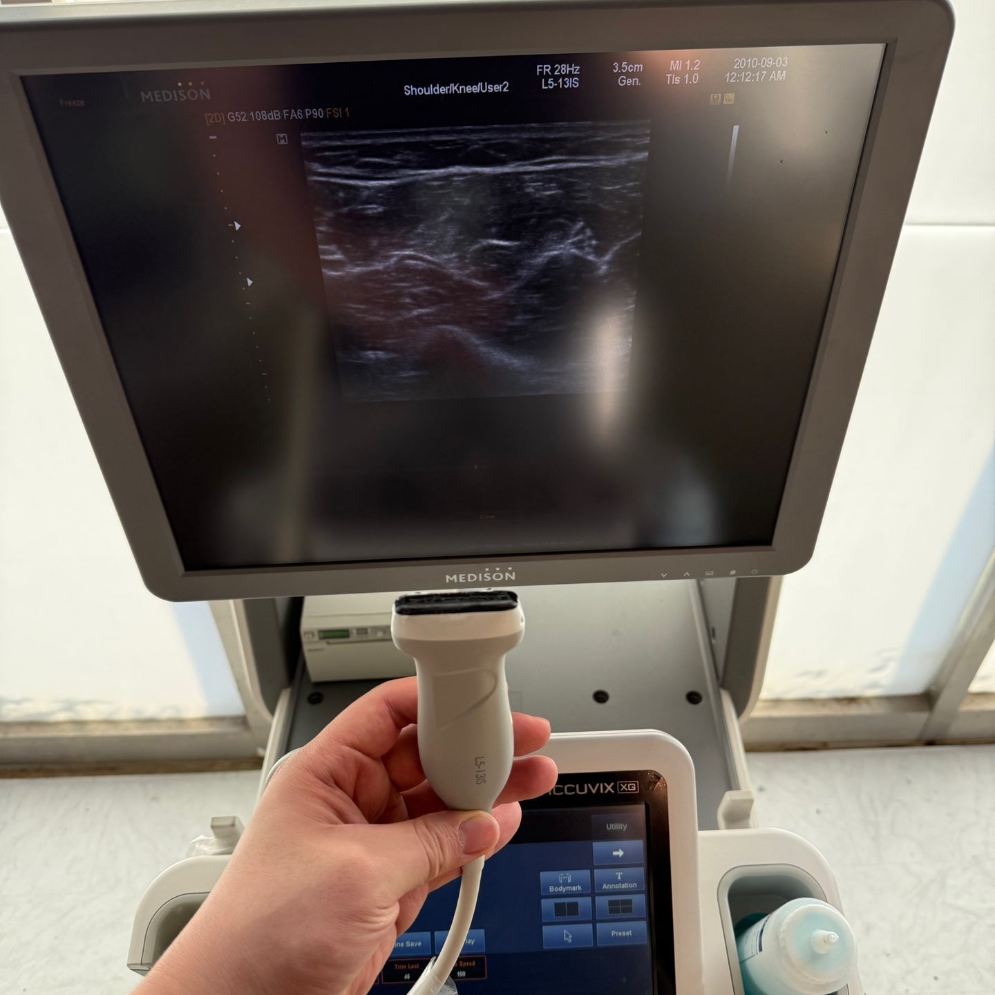 Used Samsung Medison accuvix XG With Convex Linear Vaginal 3Probes