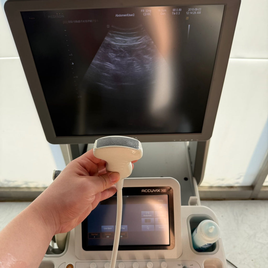 Samsung Medison accuvix XG with Convex, Linear & Vaginal 3 Probes