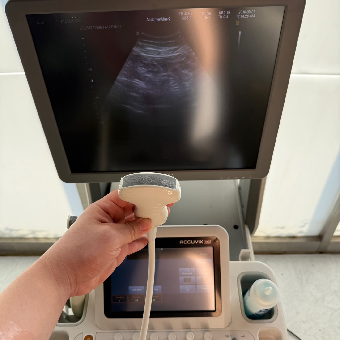 Used Samsung Medison accuvix XG With Convex Linear Vaginal 3Probes
