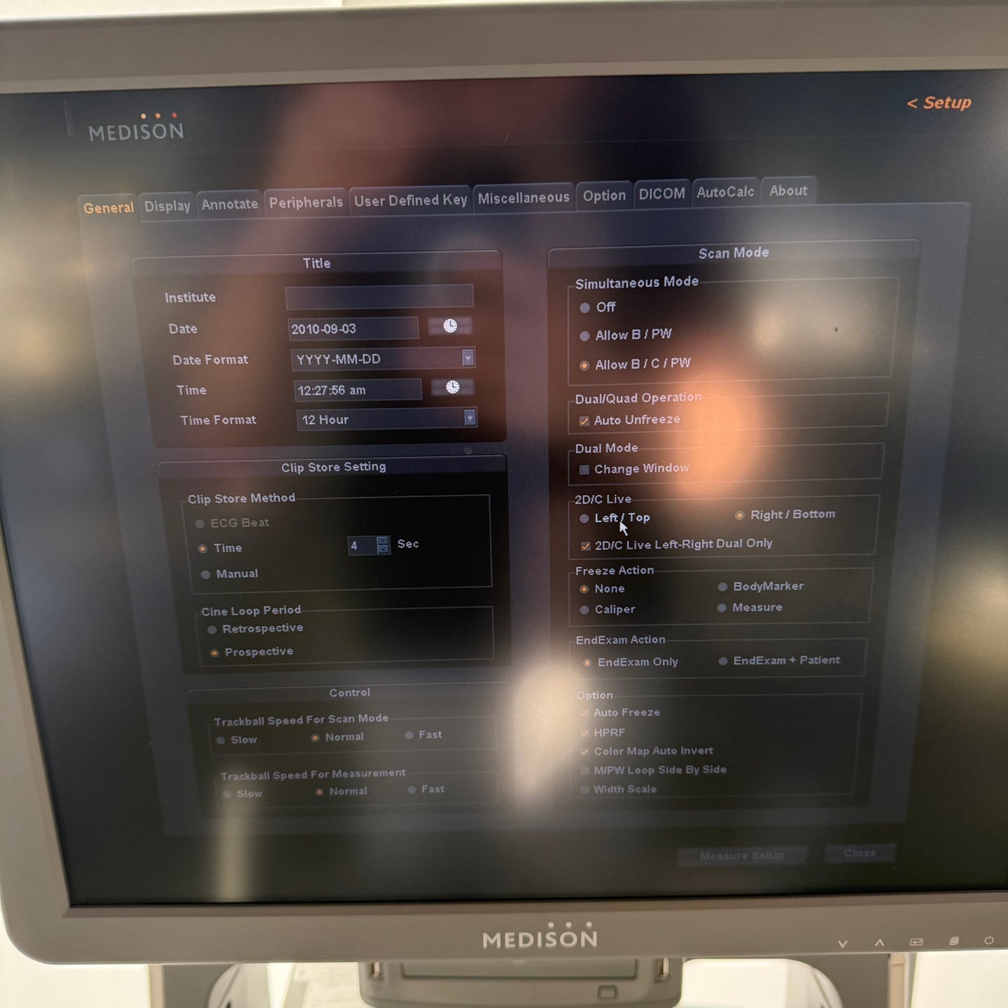 Samsung Medison accuvix XG with Convex, Linear & Vaginal 3 Probes