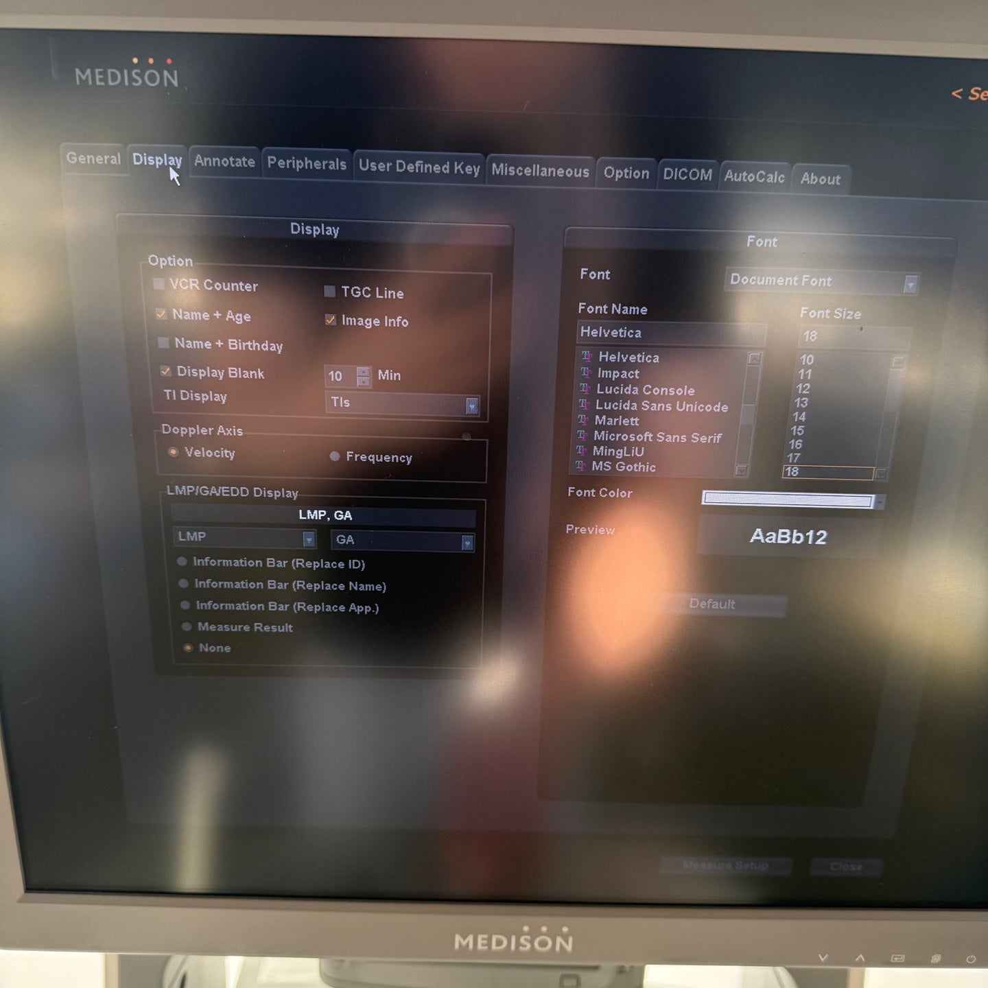Samsung Medison accuvix XG with Convex, Linear & Vaginal 3 Probes