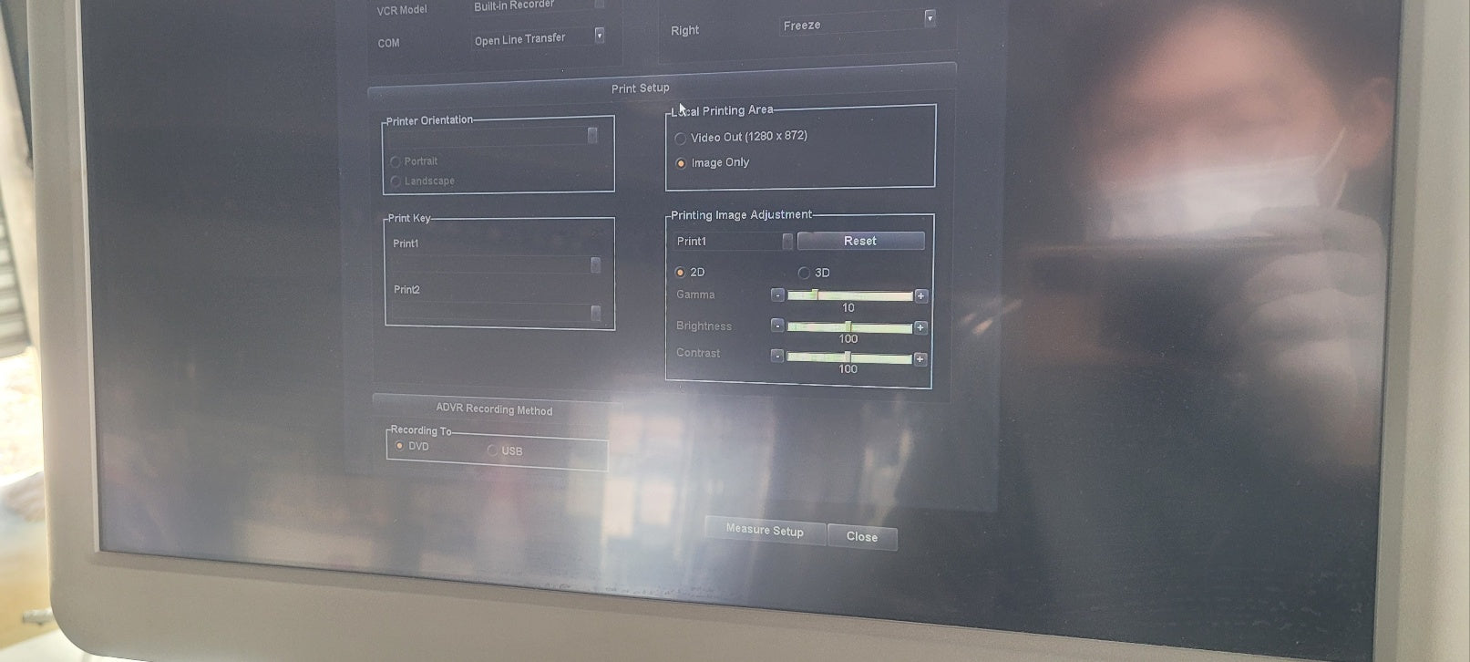 Used Medison accuvix A30 3D/4D With Convex Linear Vaginal 3 Probes