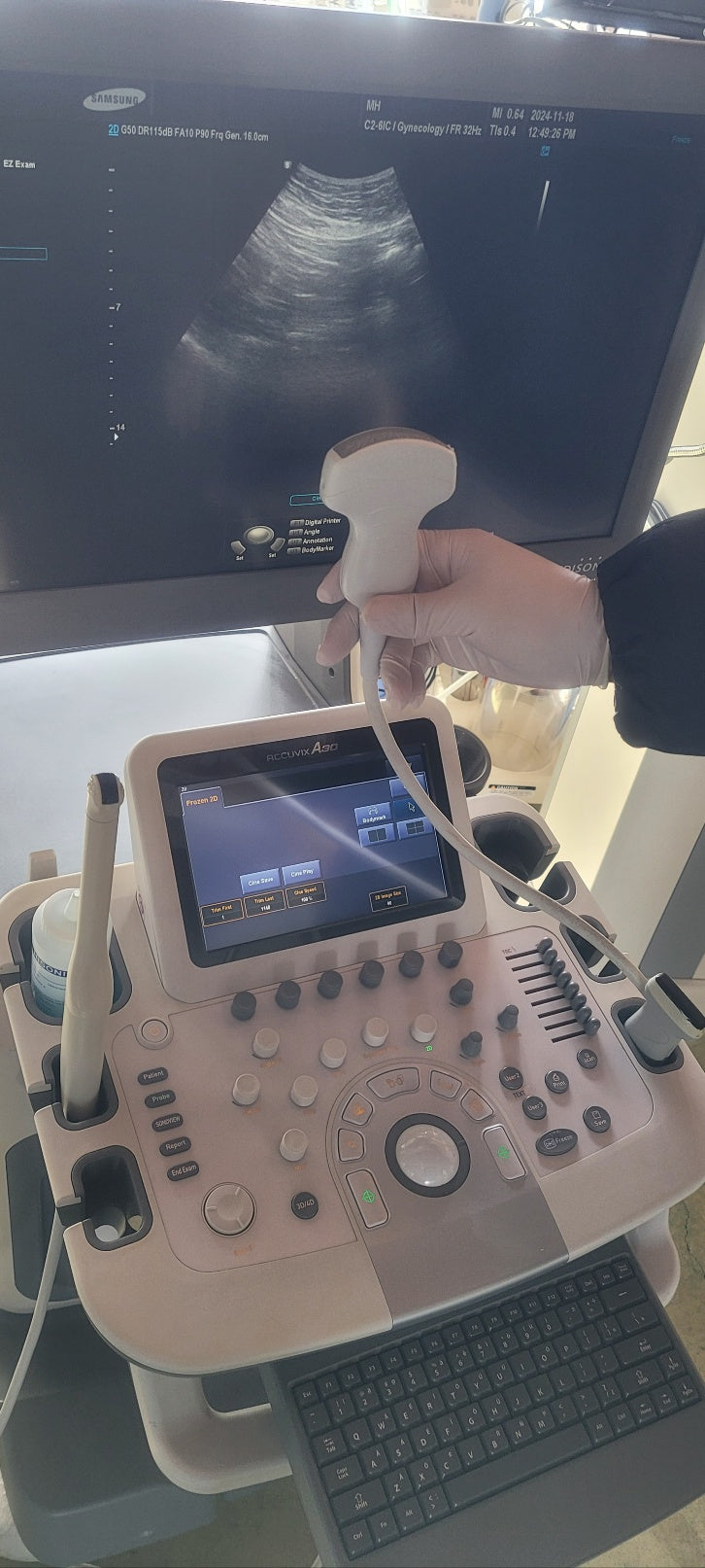 Used Medison accuvix A30 3D/4D With Convex Linear Vaginal 3 Probes