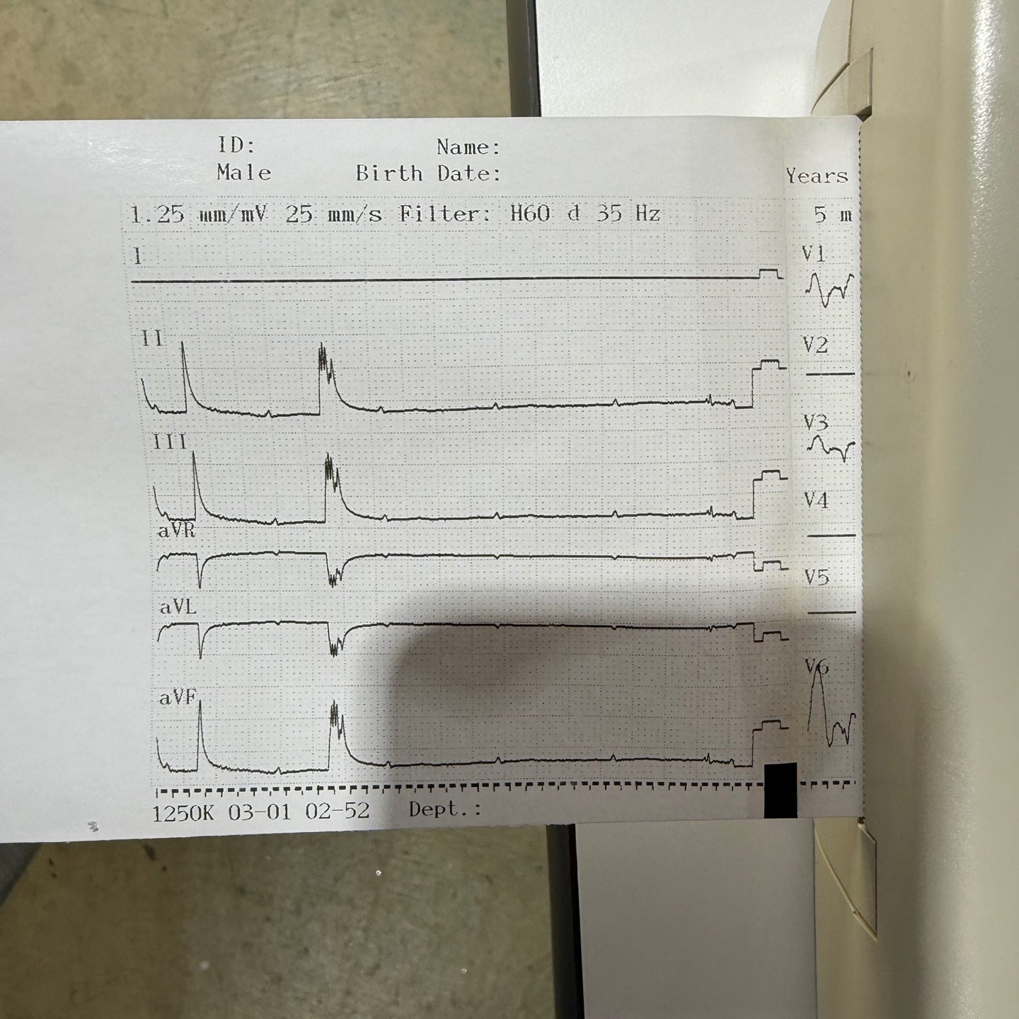 Nihon Kohden Cardiofax S EKG ECG Machine
