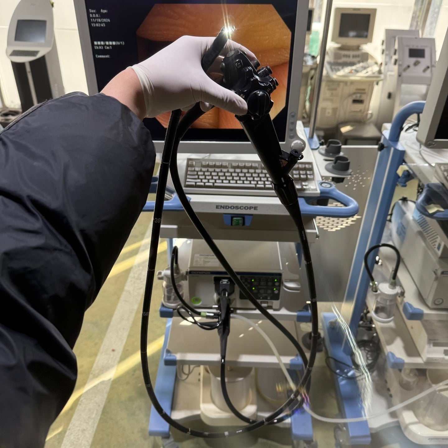 Olympus CV170 GIF H170 Gastroscope Full Endoscope System (2 Units)