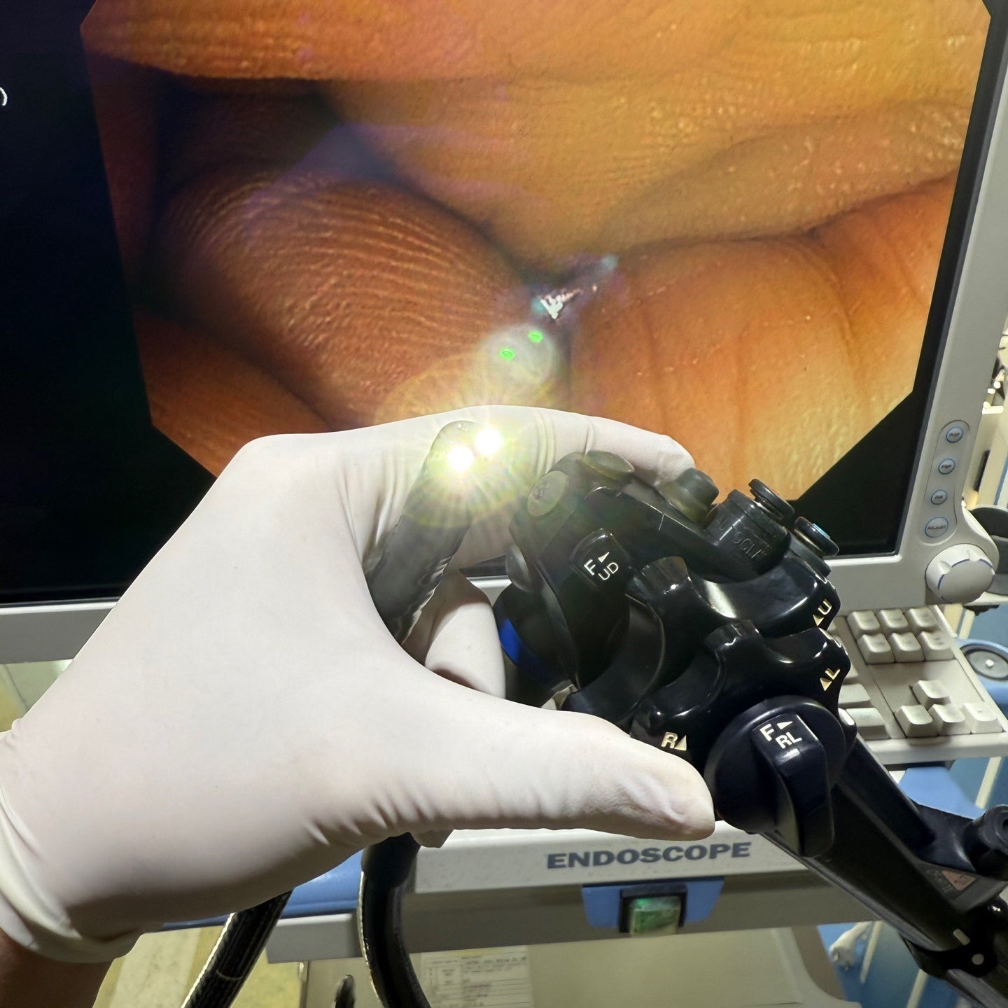 Olympus CV170 GIF H170 Gastroscope Full Endoscope System (2 Units)