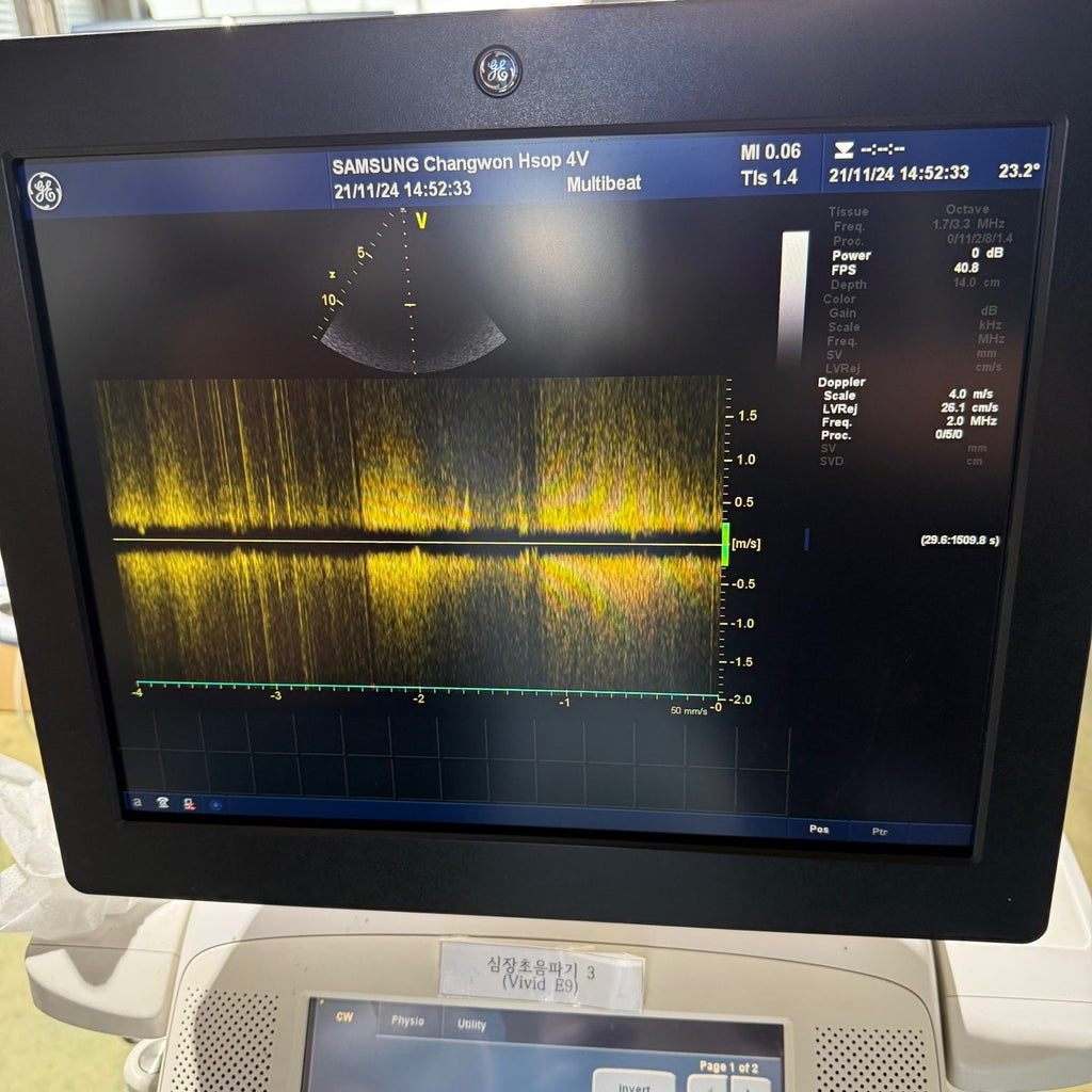 GE Vivid E9 XDclear 4D with 3 Probes