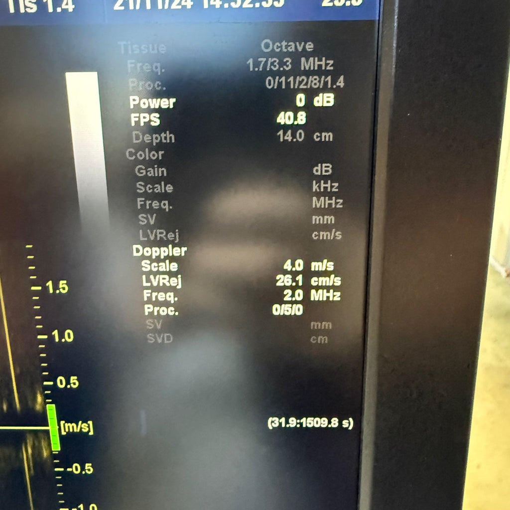 GE Vivid E9 XDclear 4D with 3 Probes