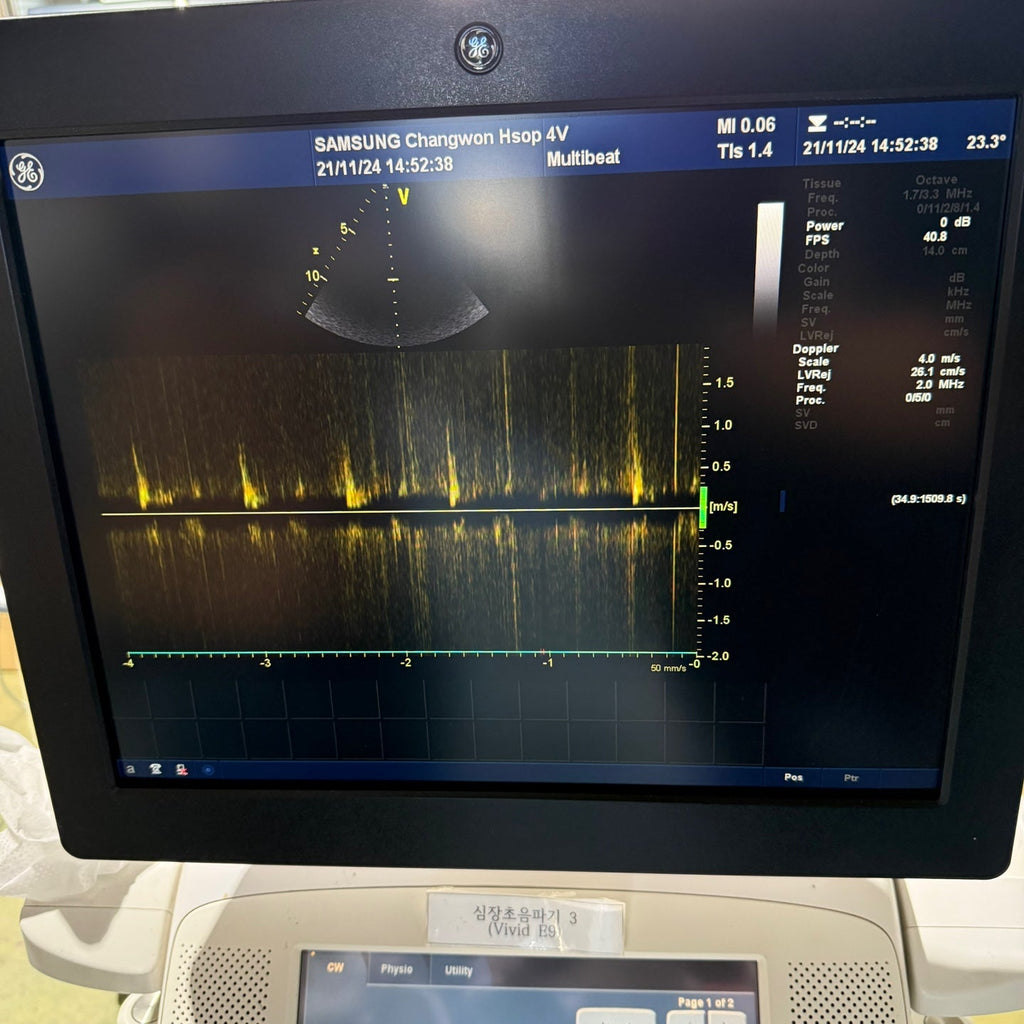 GE Vivid E9 XDclear 4D with 3 Probes