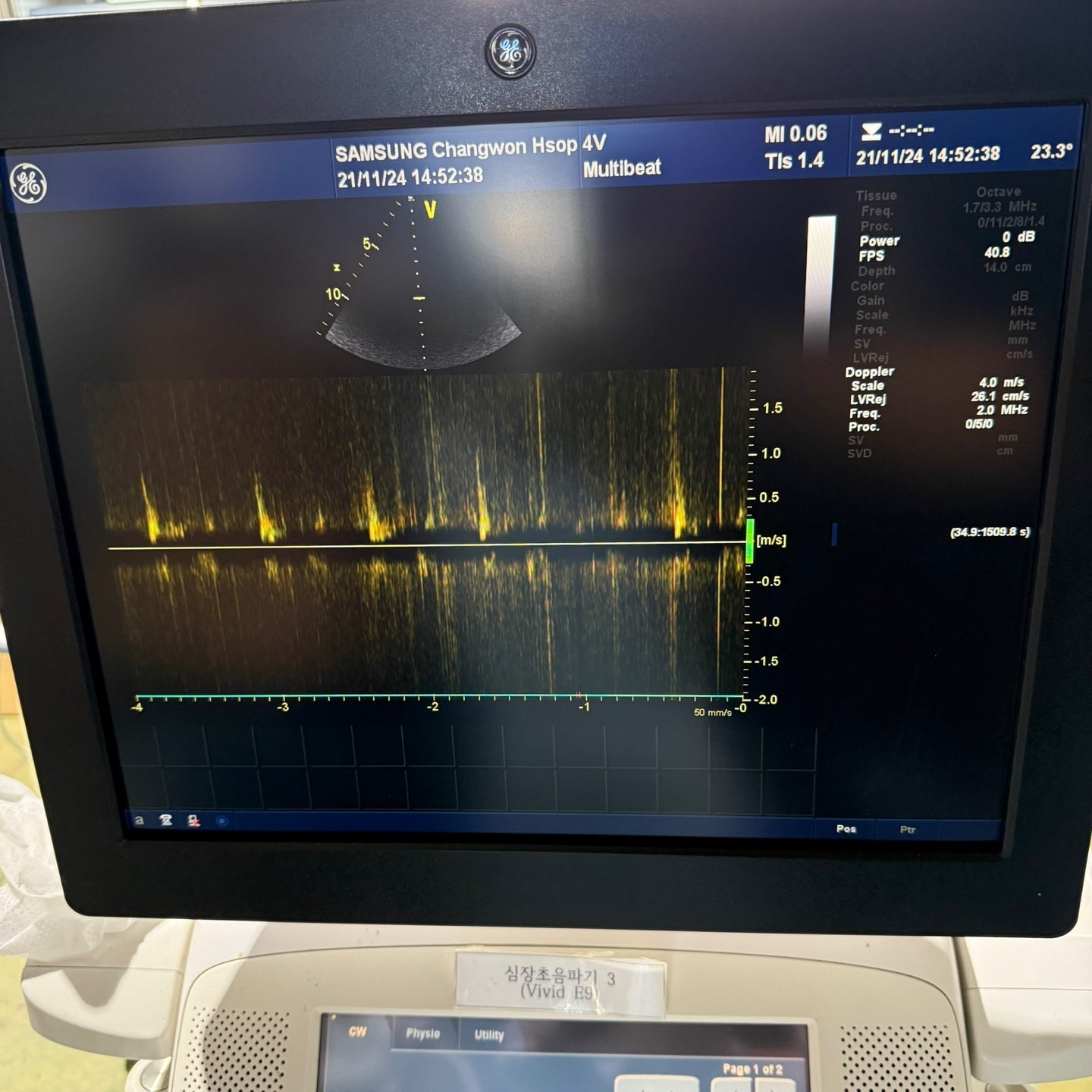 GE Vivid E9 XDclear 4D with 3 Probes