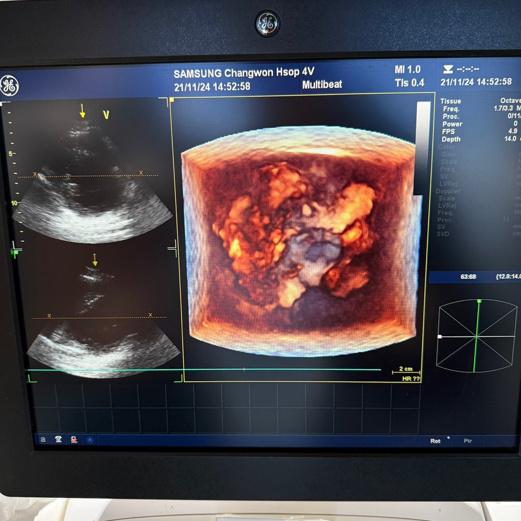 GE Vivid E9 XDclear 4D with 3 Probes