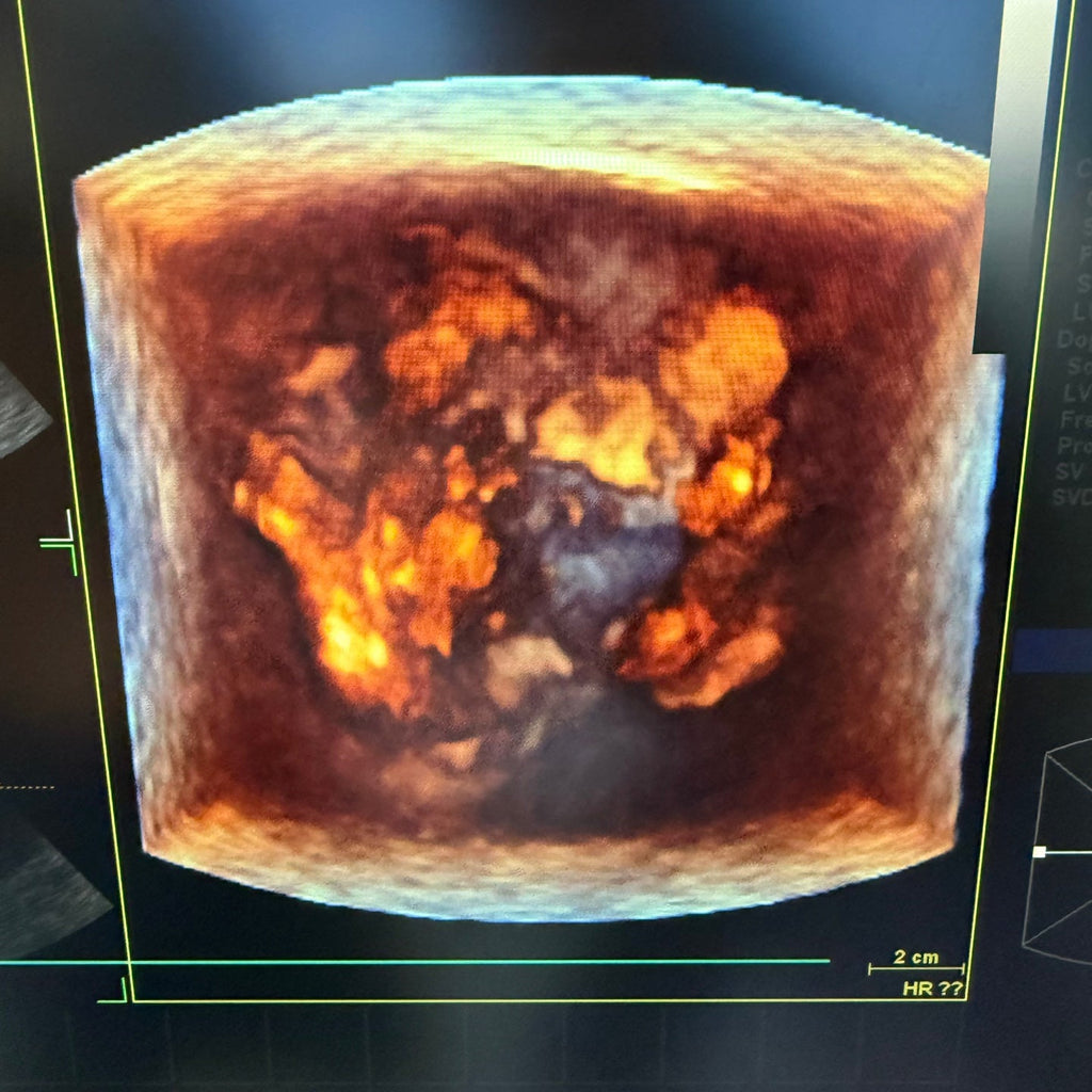 GE Vivid E9 XDclear 4D with 3 Probes