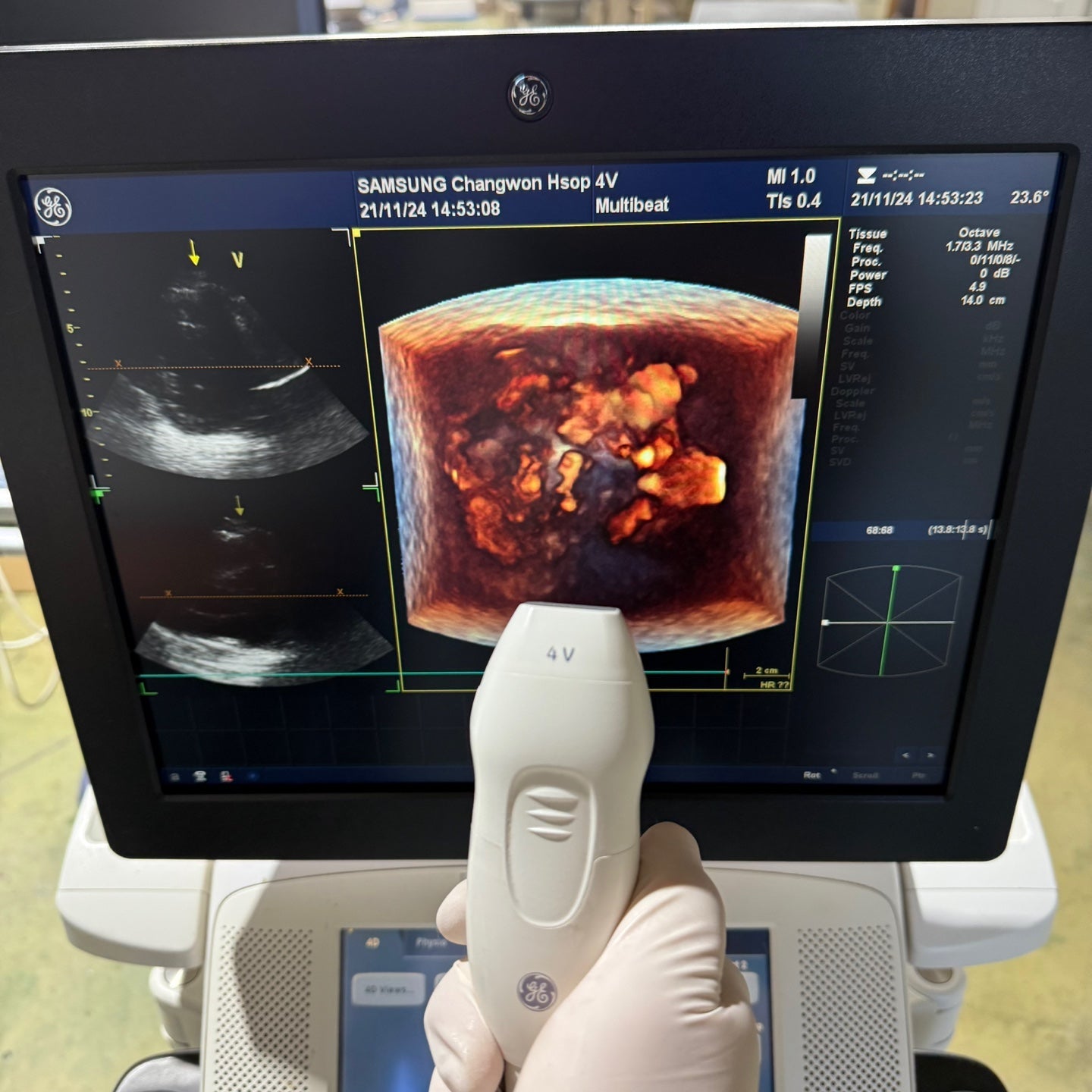 GE Vivid E9 XDclear 4D with 3 Probes