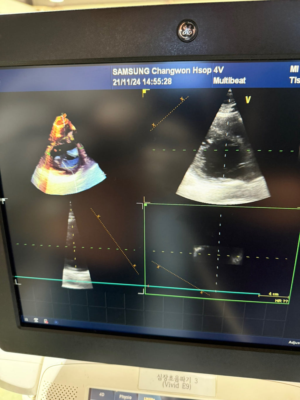 GE Vivid E9 XDclear 4D with 3 Probes