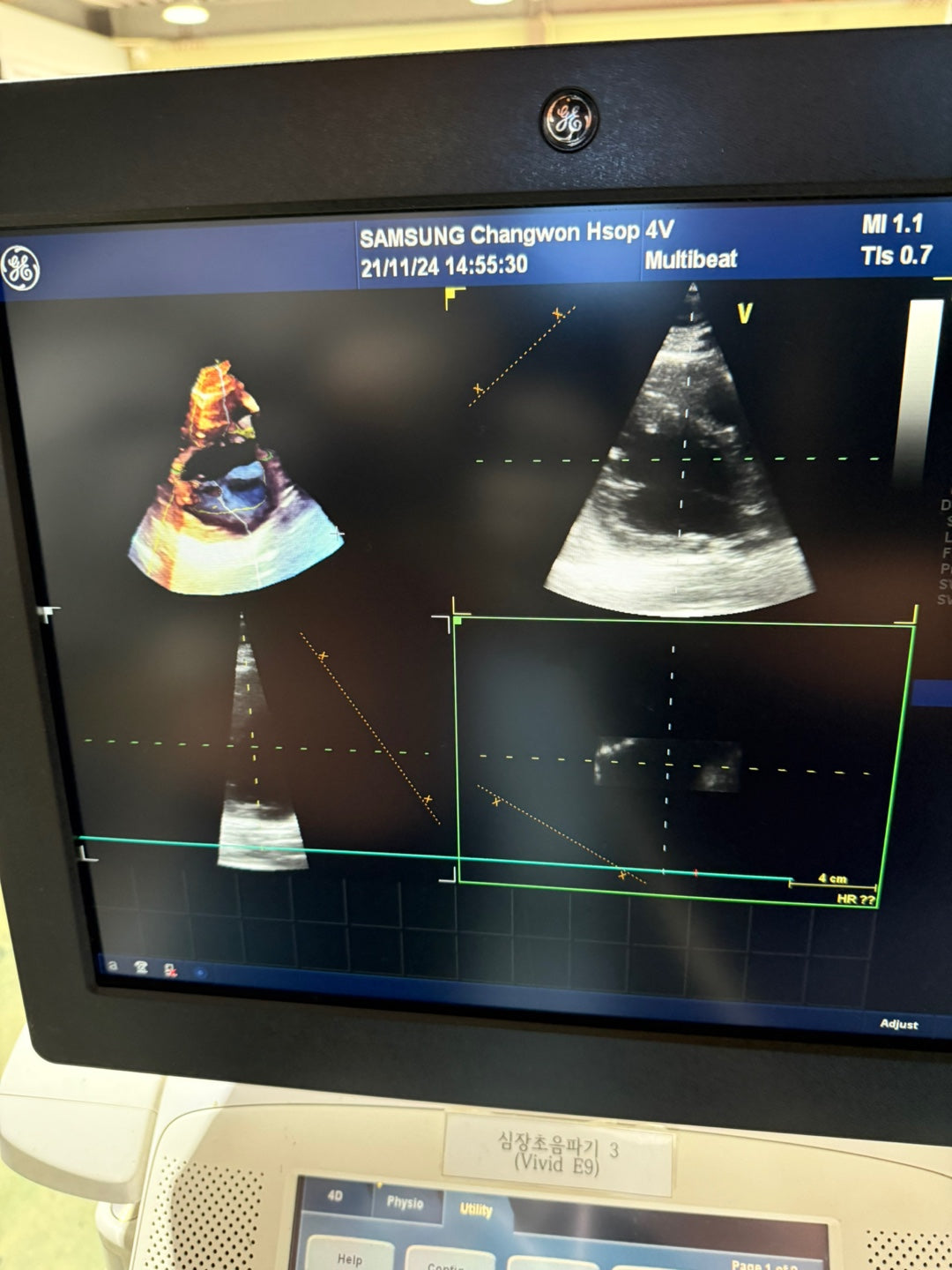 GE Vivid E9 XDclear 4D with 3 Probes