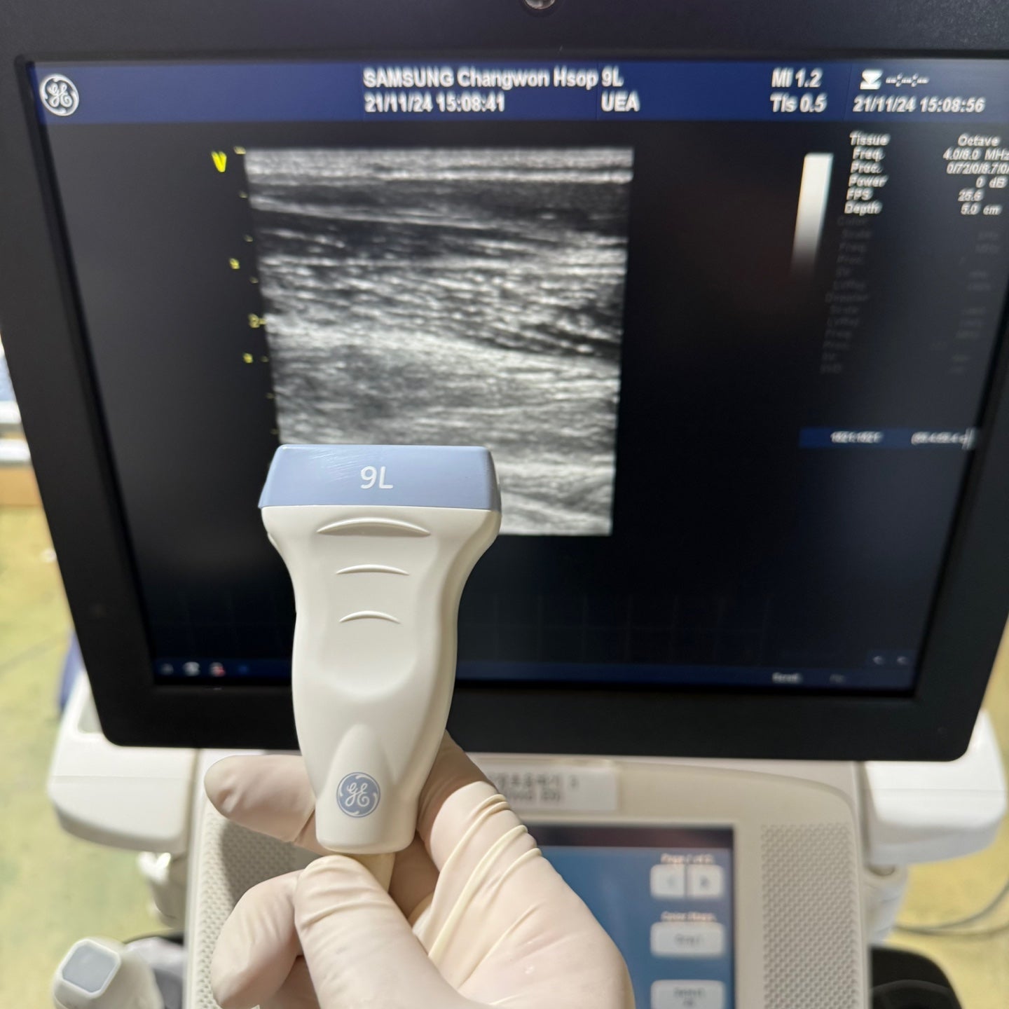 GE Vivid E9 XDclear 4D with 3 Probes
