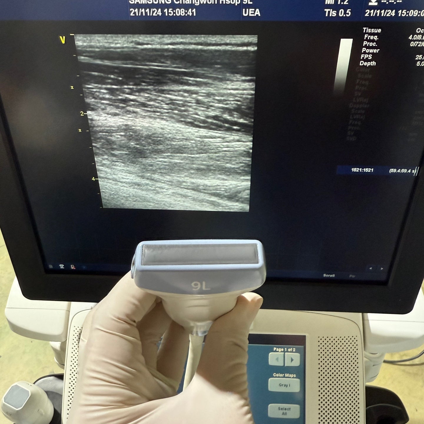 GE Vivid E9 XDclear 4D with 3 Probes