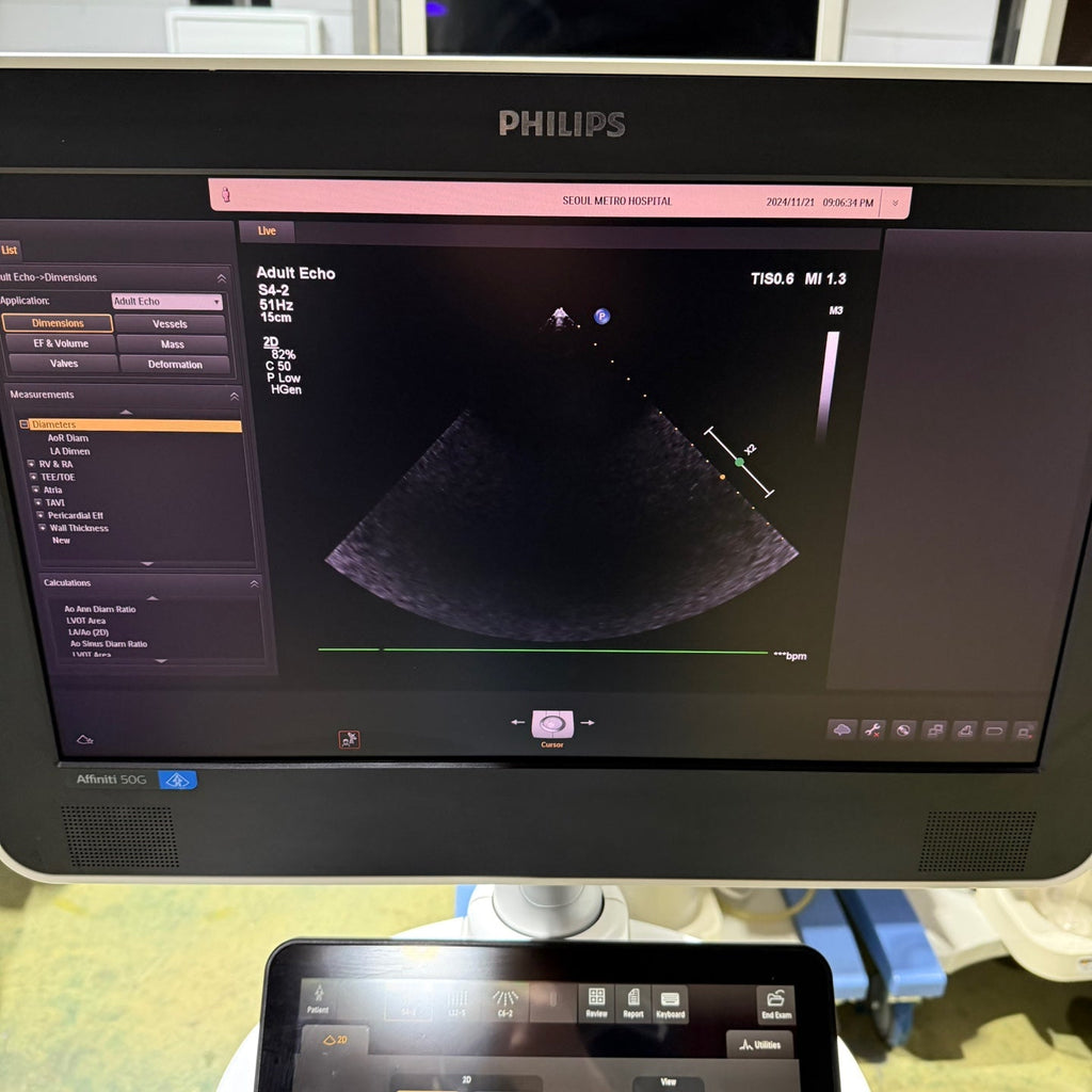 Philips Affiniti 50G with Cardiac, Convex & Linear 3 Probes