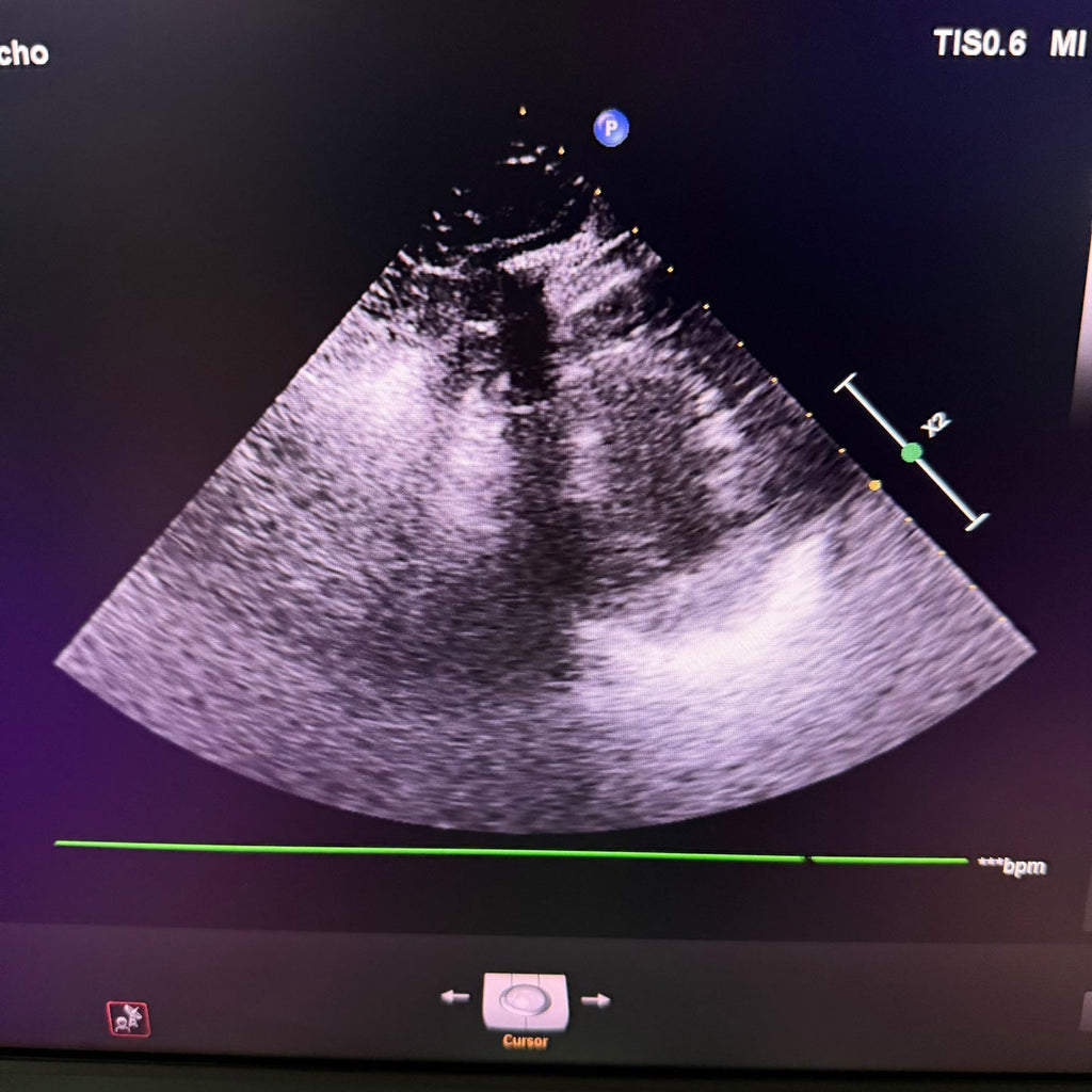 Philips Affiniti 50G with Cardiac, Convex & Linear 3 Probes