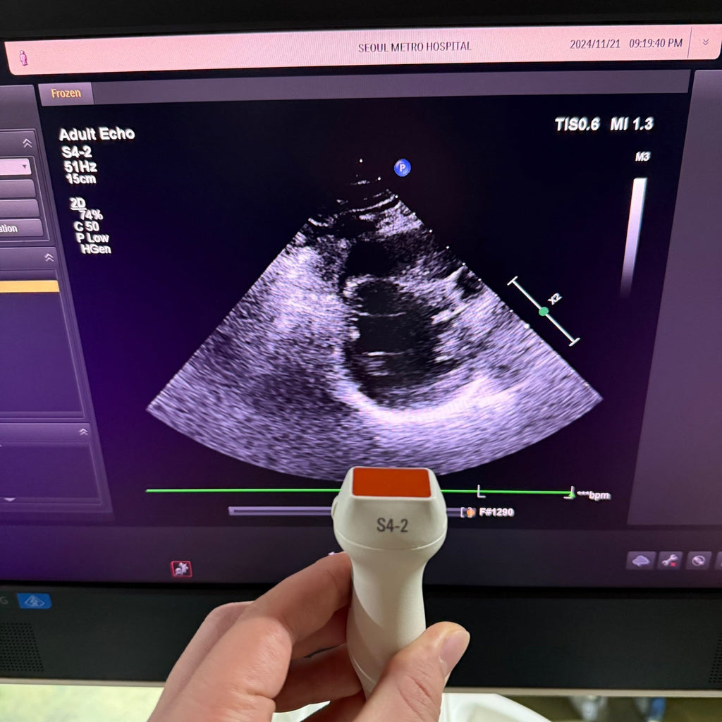 Philips Affiniti 50G with Cardiac, Convex & Linear 3 Probes