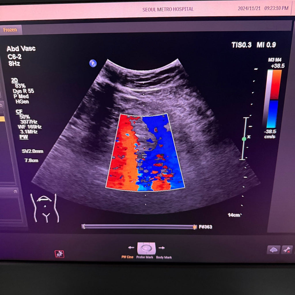 Philips Affiniti 50G with Cardiac, Convex & Linear 3 Probes
