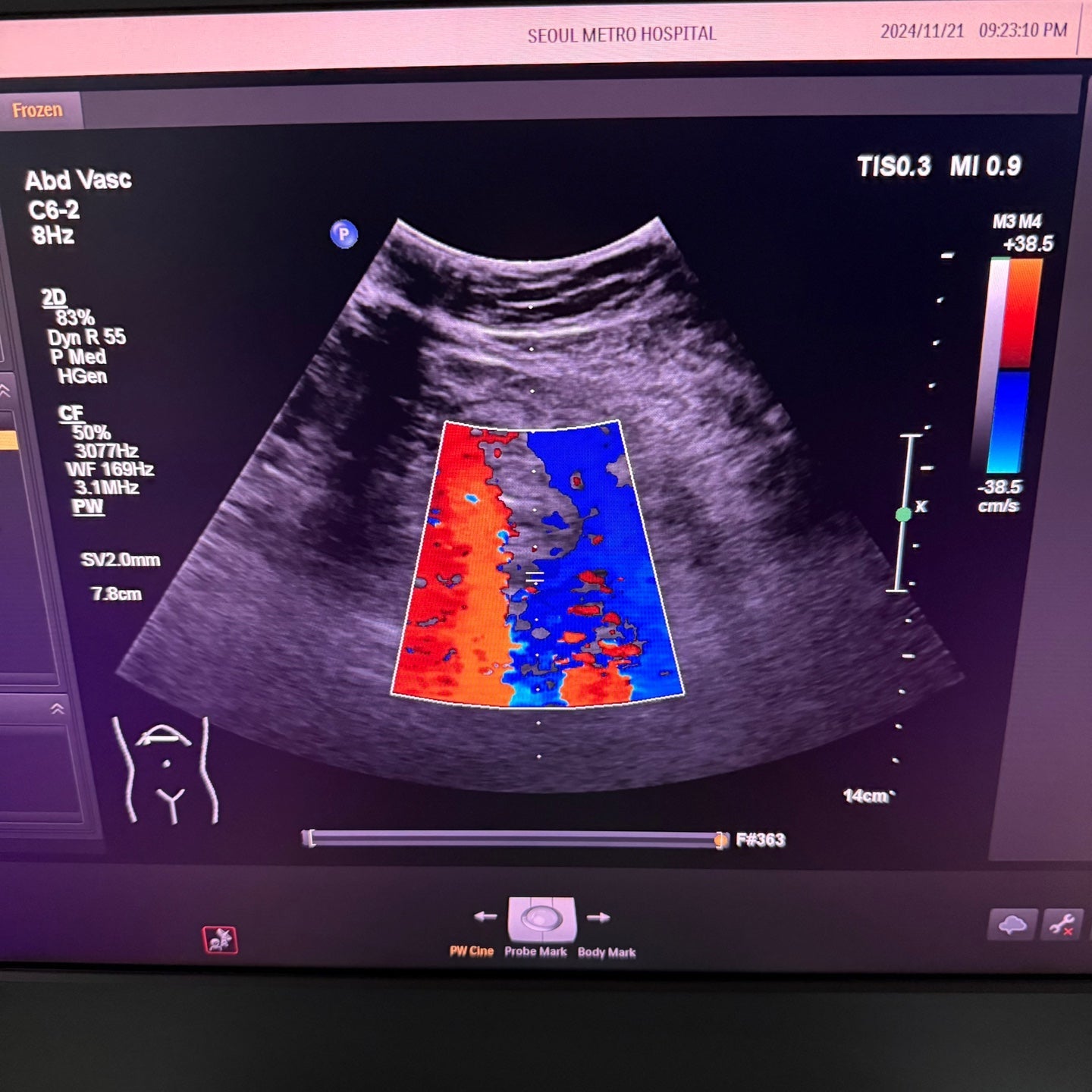 Philips Affiniti 50G with Cardiac, Convex & Linear 3 Probes