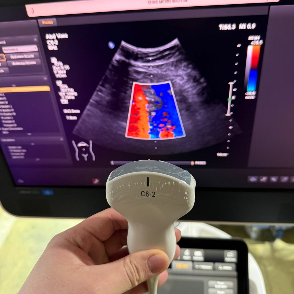 Philips Affiniti 50G with Cardiac, Convex & Linear 3 Probes