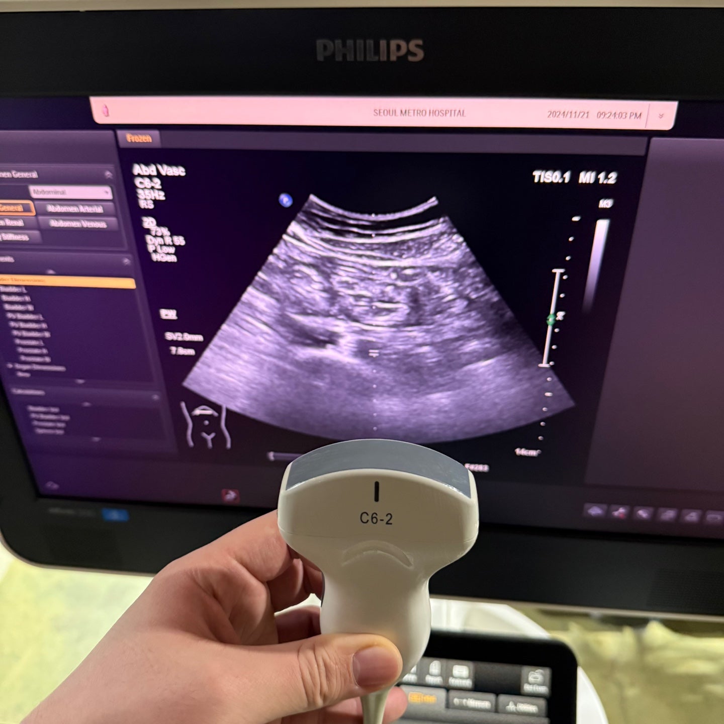 Philips Affiniti 50G with Cardiac, Convex & Linear 3 Probes