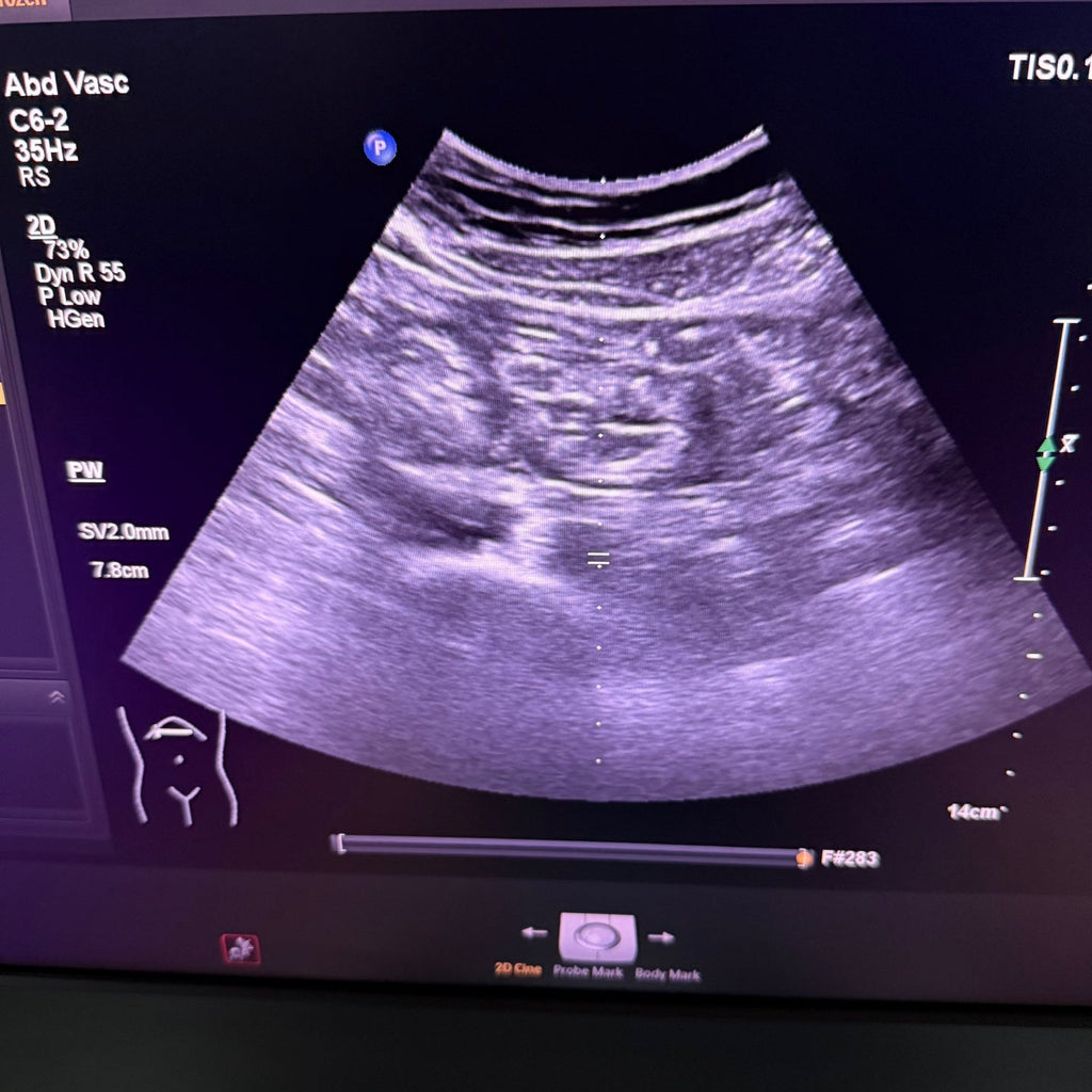 Philips Affiniti 50G with Cardiac, Convex & Linear 3 Probes
