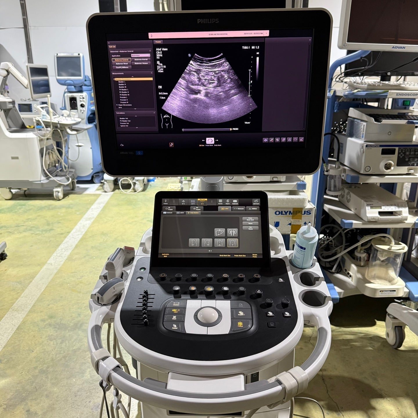 Philips Affiniti 50G with Cardiac, Convex & Linear 3 Probes