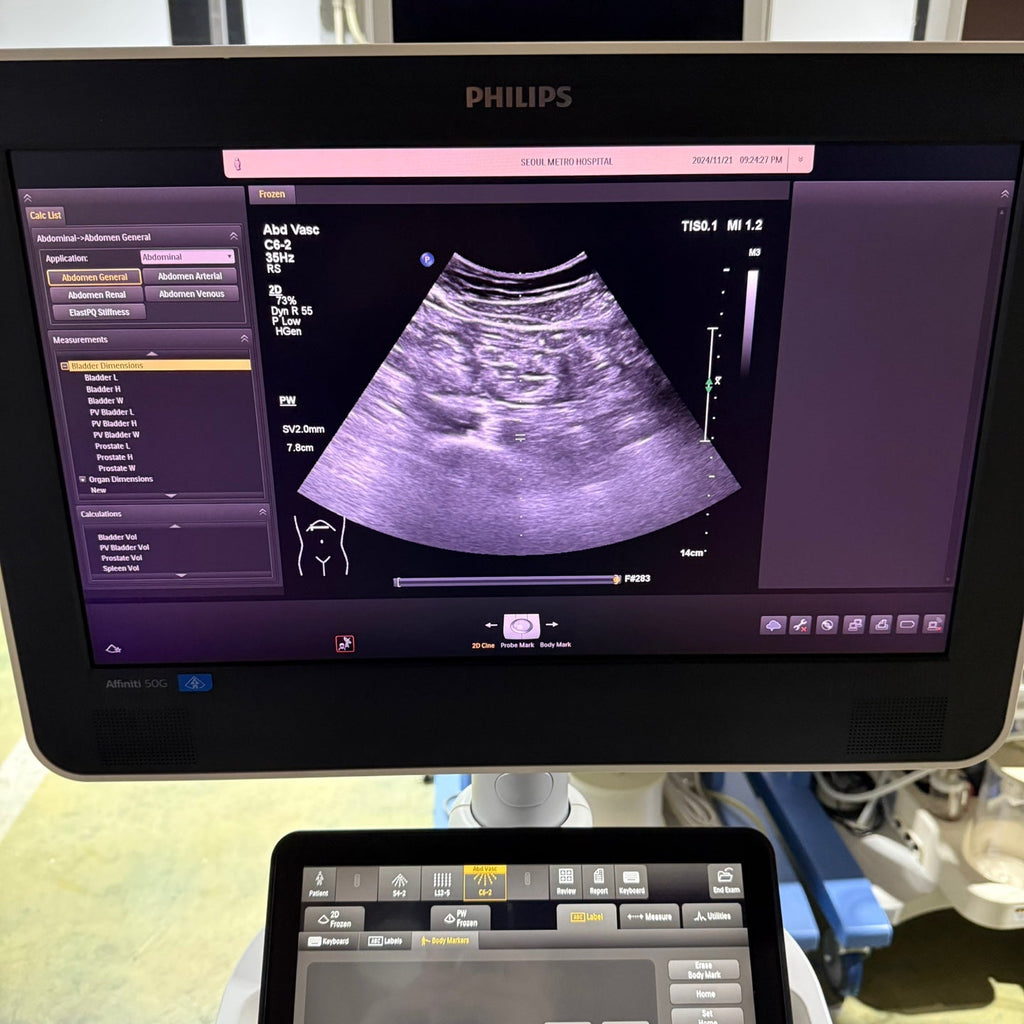 Philips Affiniti 50G with Cardiac, Convex & Linear 3 Probes