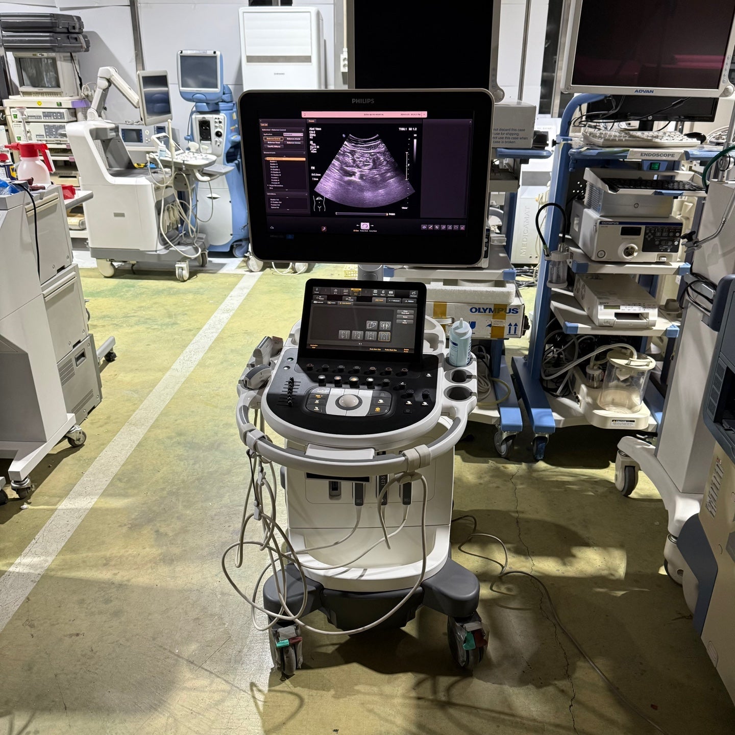 Philips Affiniti 50G with Cardiac, Convex & Linear 3 Probes