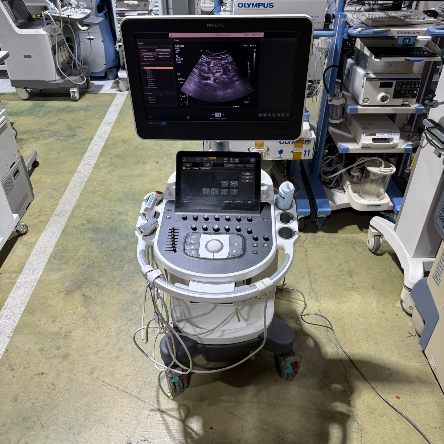 Philips Affiniti 50G with Cardiac, Convex & Linear 3 Probes