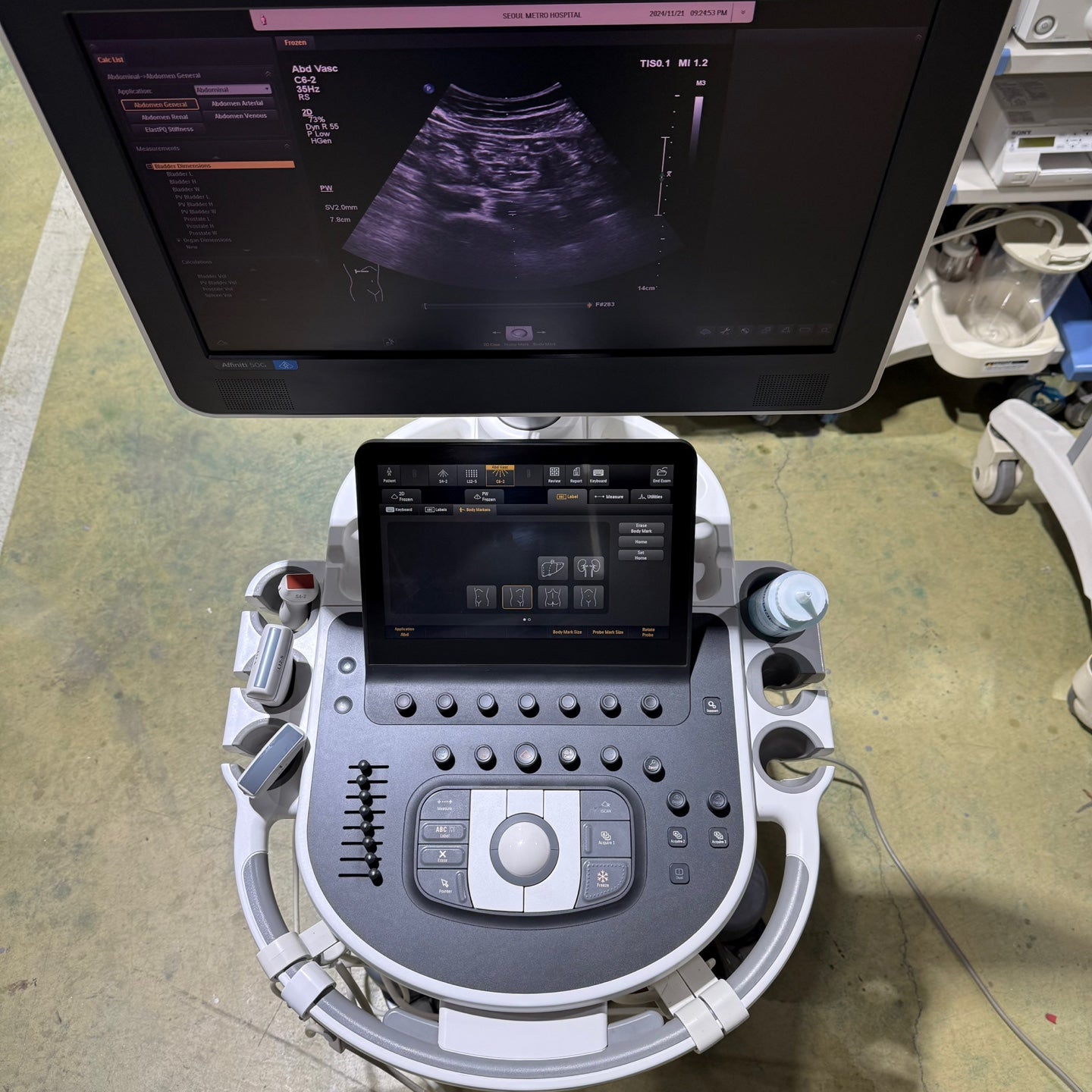 Philips Affiniti 50G with Cardiac, Convex & Linear 3 Probes