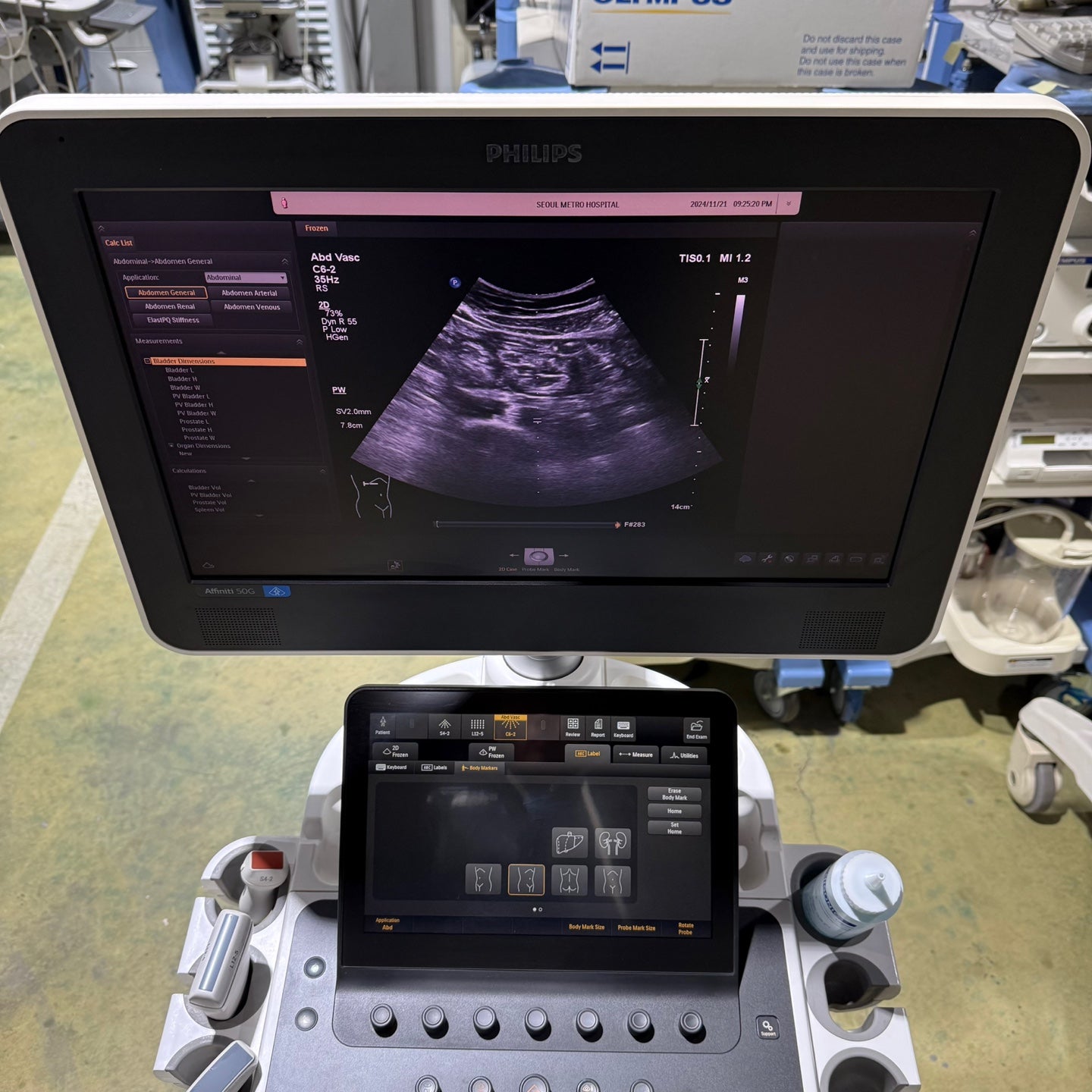 Philips Affiniti 50G with Cardiac, Convex & Linear 3 Probes