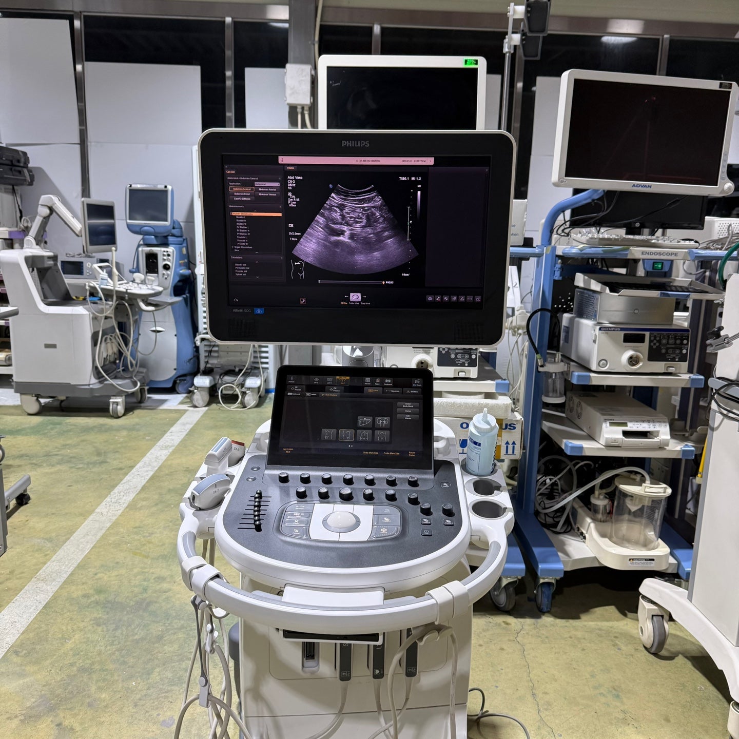 Philips Affiniti 50G with Cardiac, Convex & Linear 3 Probes