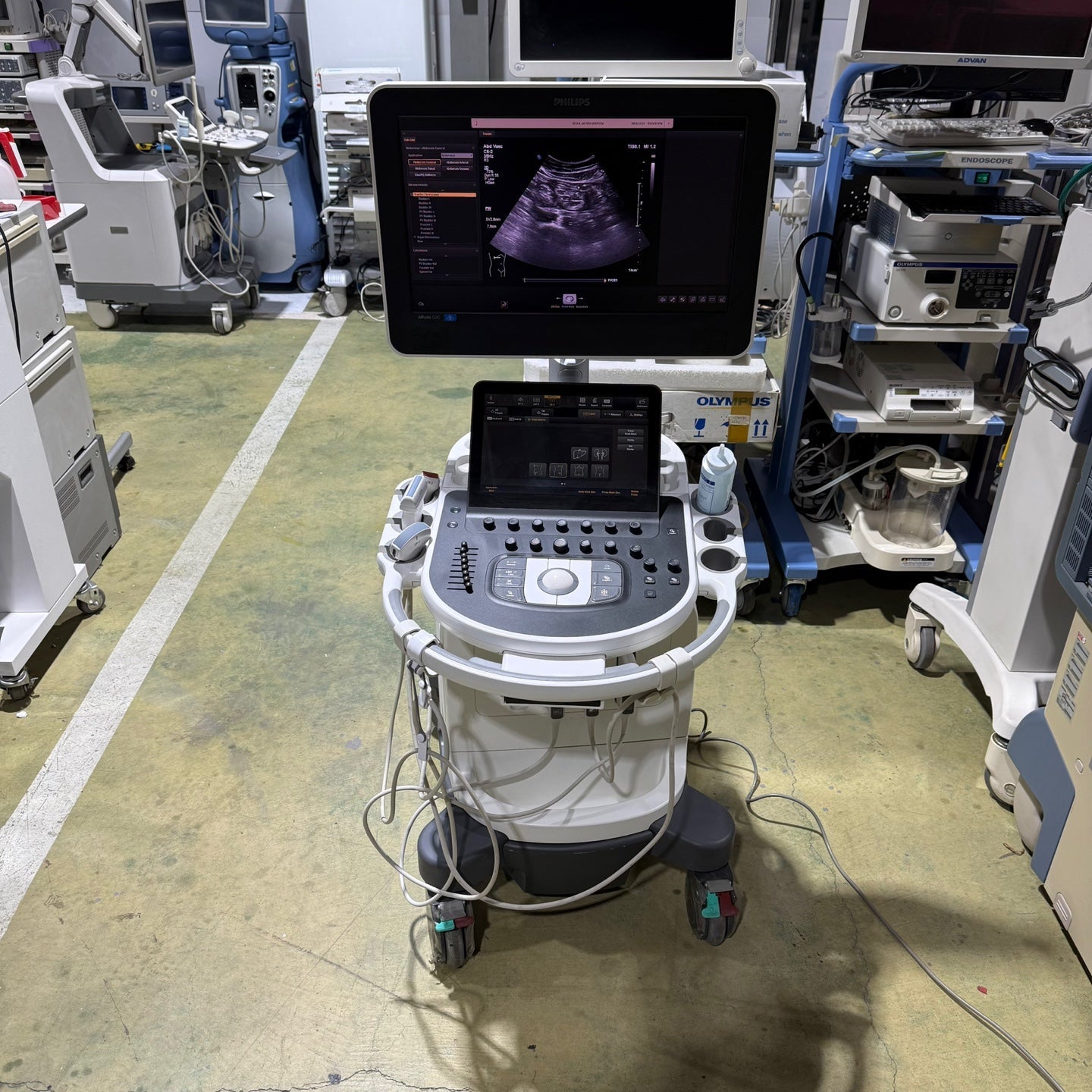Philips Affiniti 50G with Cardiac, Convex & Linear 3 Probes