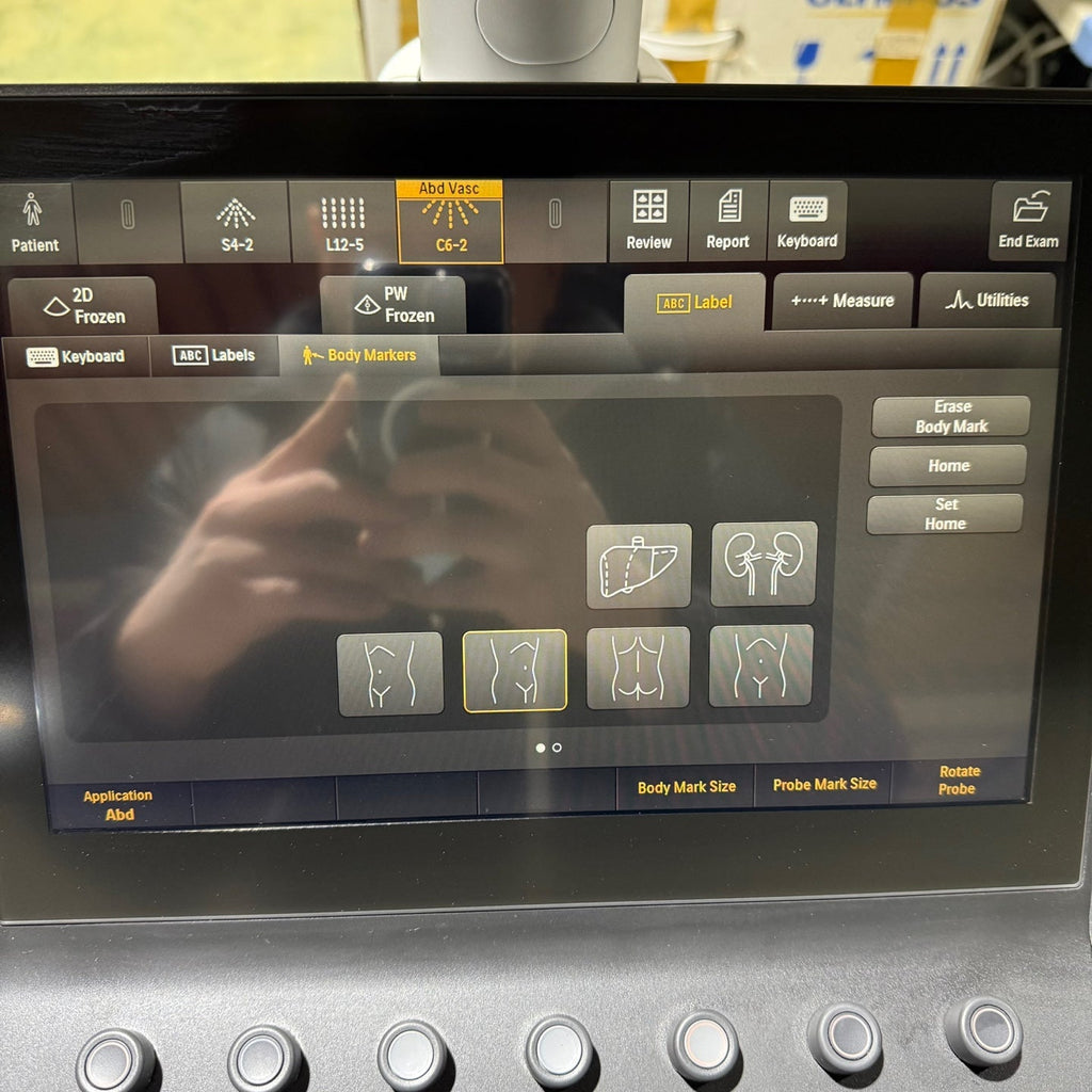 Philips Affiniti 50G with Cardiac, Convex & Linear 3 Probes