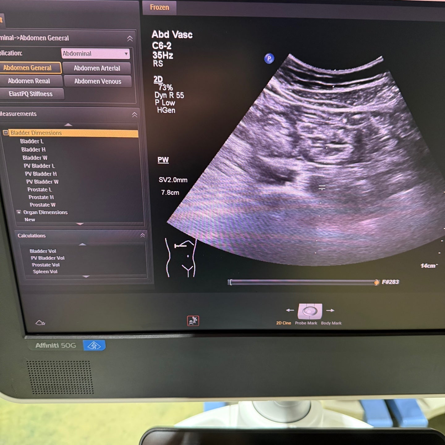 Philips Affiniti 50G with Cardiac, Convex & Linear 3 Probes