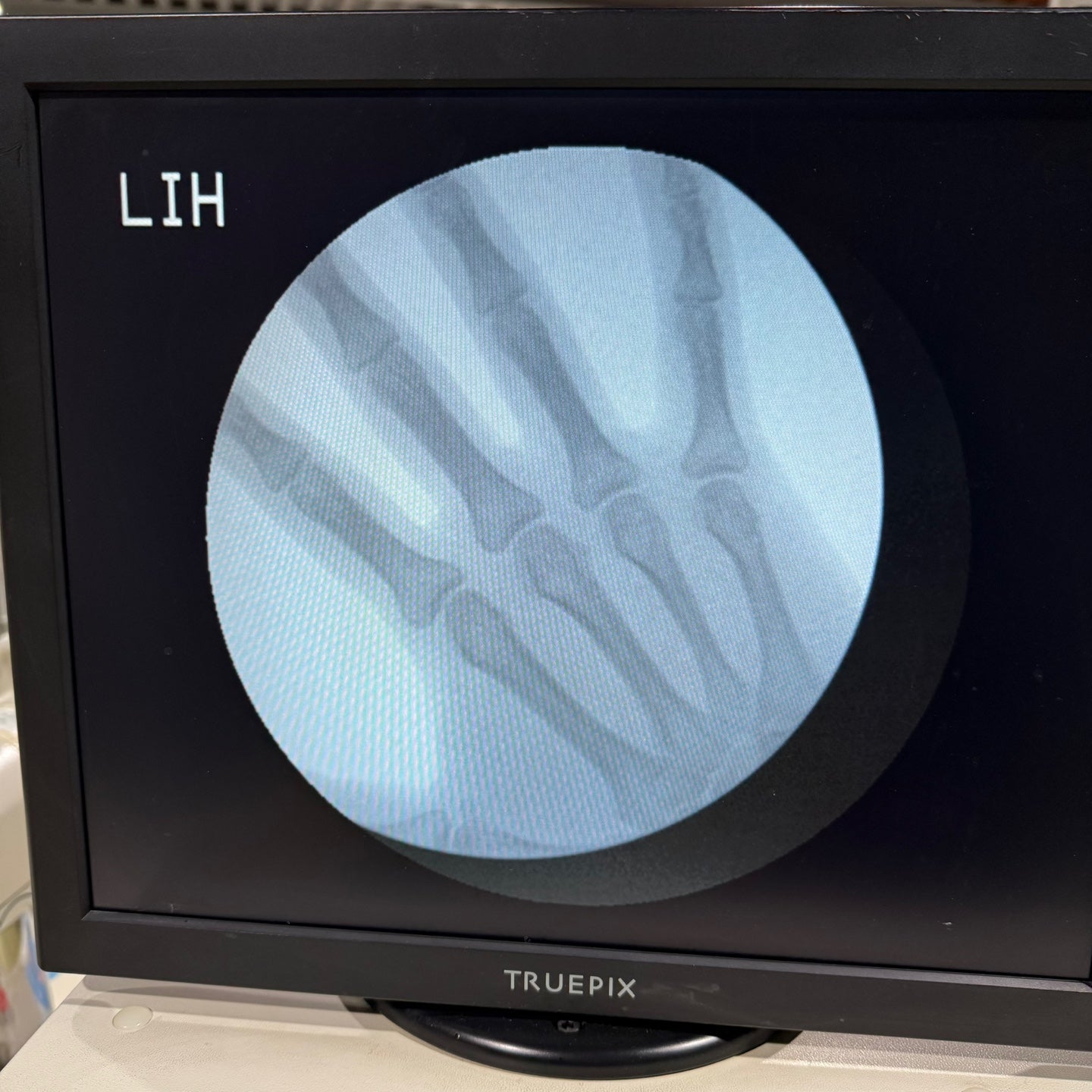 Genoray Zen2060 Brazo en C Rayos X