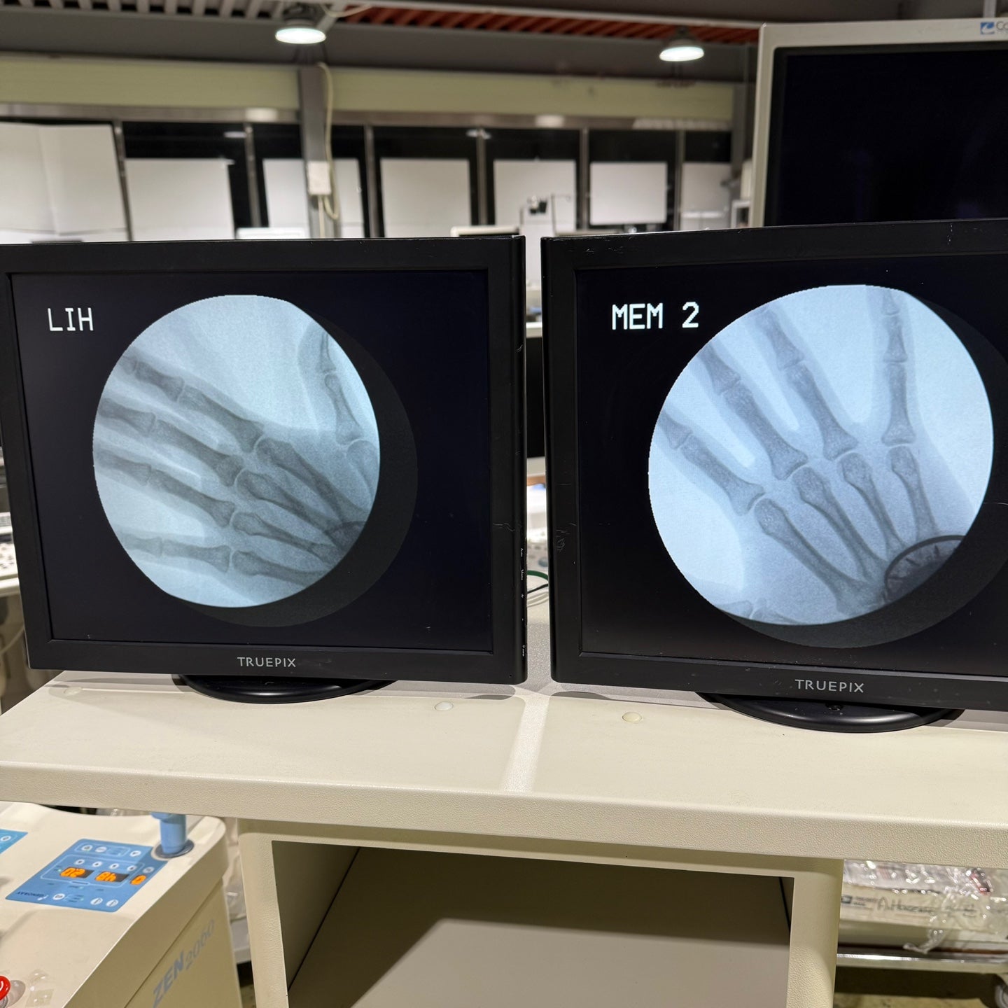 Genoray Zen2060 C arm Xray