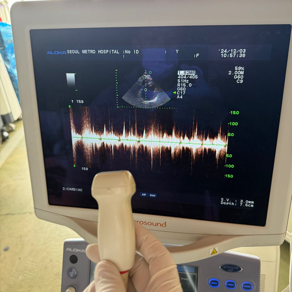 Aloka Prosound Alpha7 with Convex, Cardiac & Linear Probes