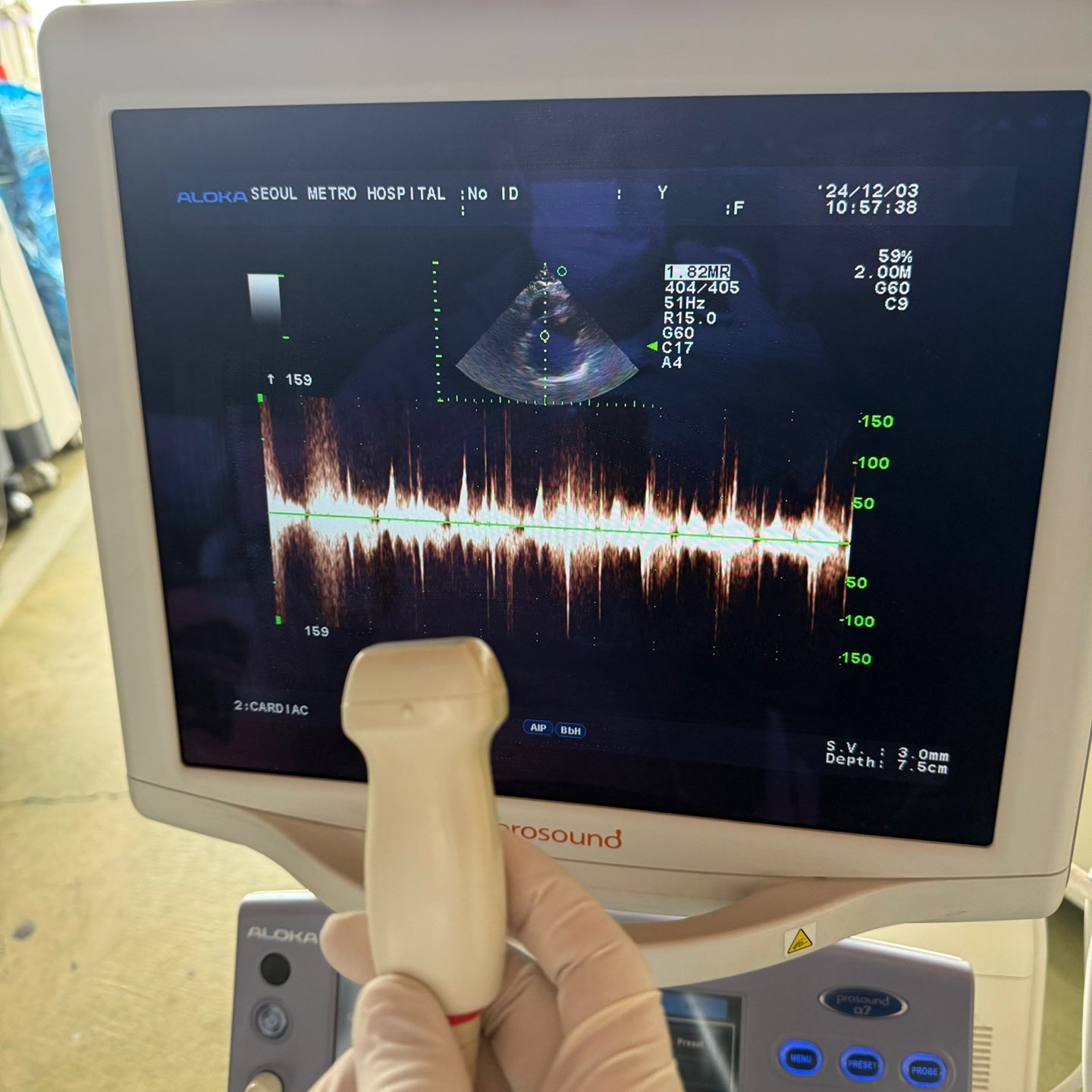 Aloka Prosound Alpha7 with Convex, Cardiac & Linear Probes