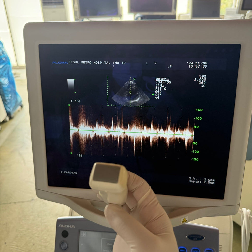 Aloka Prosound Alpha7 with Convex, Cardiac & Linear Probes