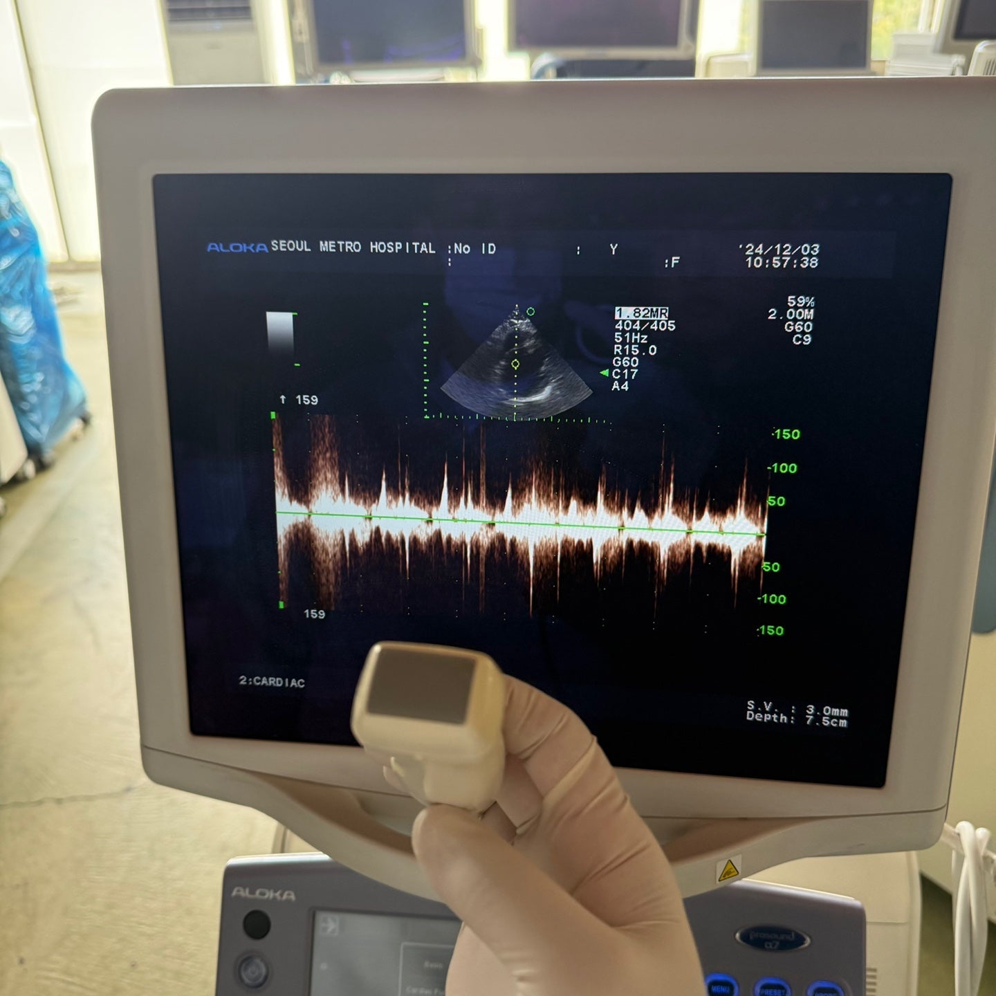 Aloka Prosound Alpha7 with Convex, Cardiac & Linear Probes