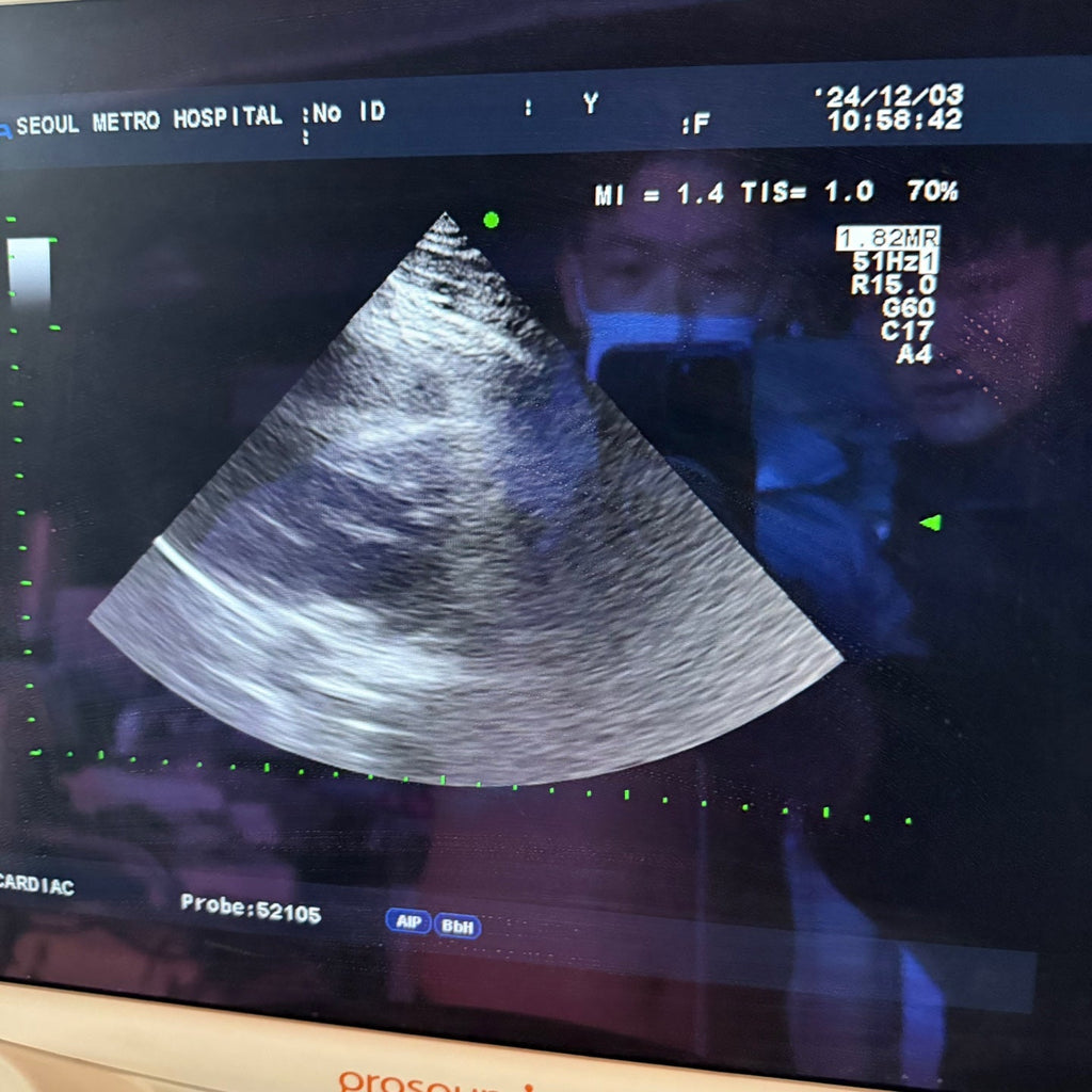 Aloka Prosound Alpha7 with Convex, Cardiac & Linear Probes