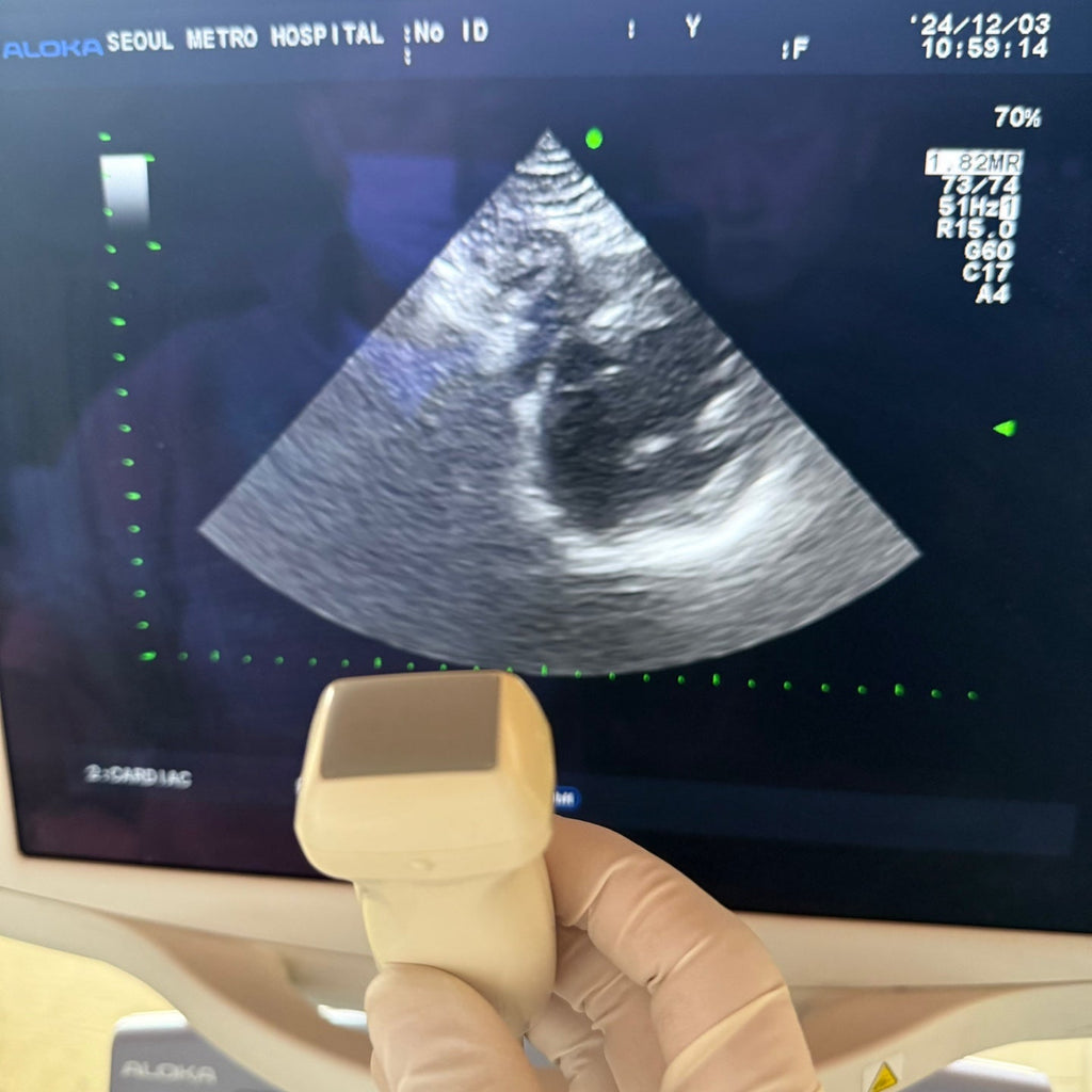 Aloka Prosound Alpha7 with Convex, Cardiac & Linear Probes