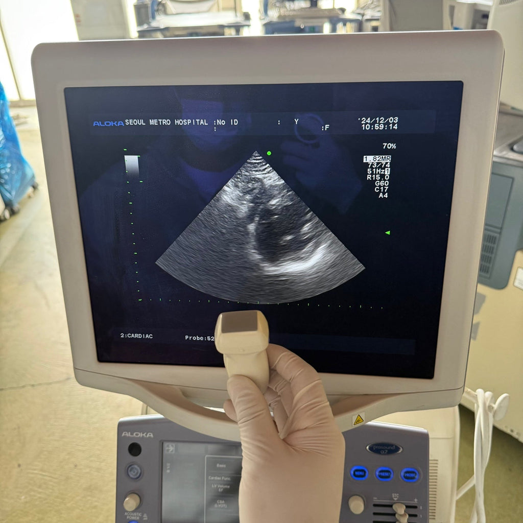 Aloka Prosound Alpha7 with Convex, Cardiac & Linear Probes
